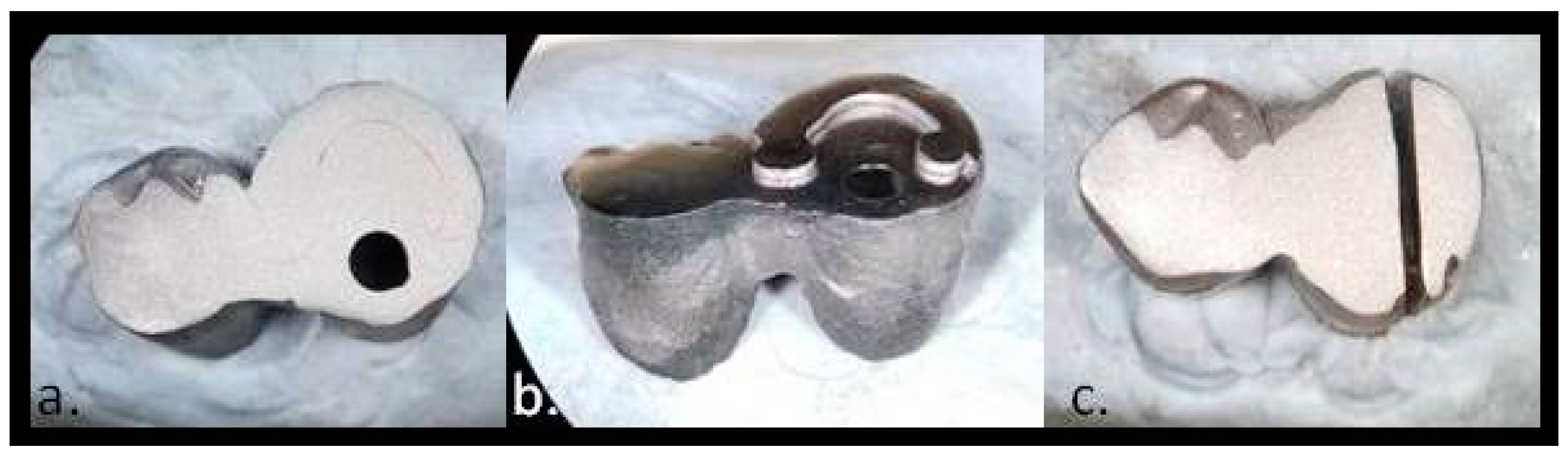 Prosthesis 03 00024 g014