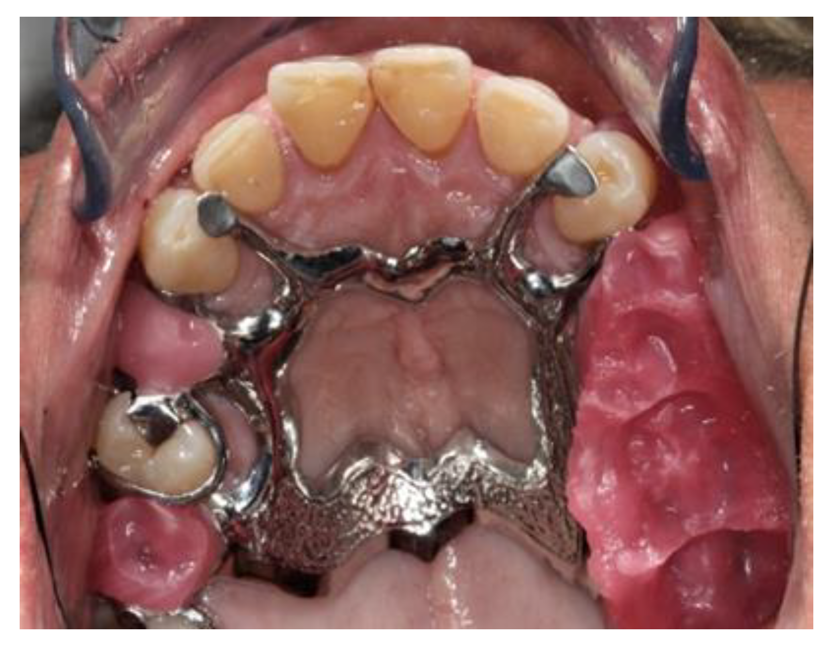 Prosthesis 03 00038 g018 550