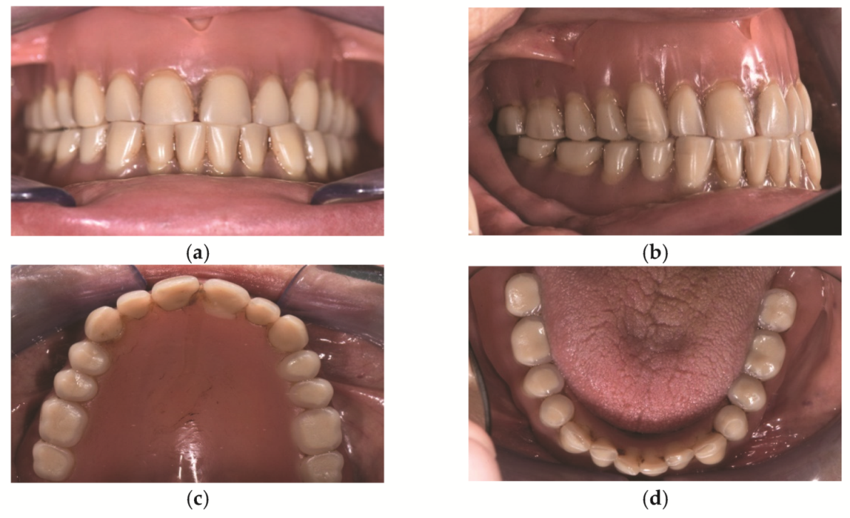 Prosthesis 03 00039 g001
