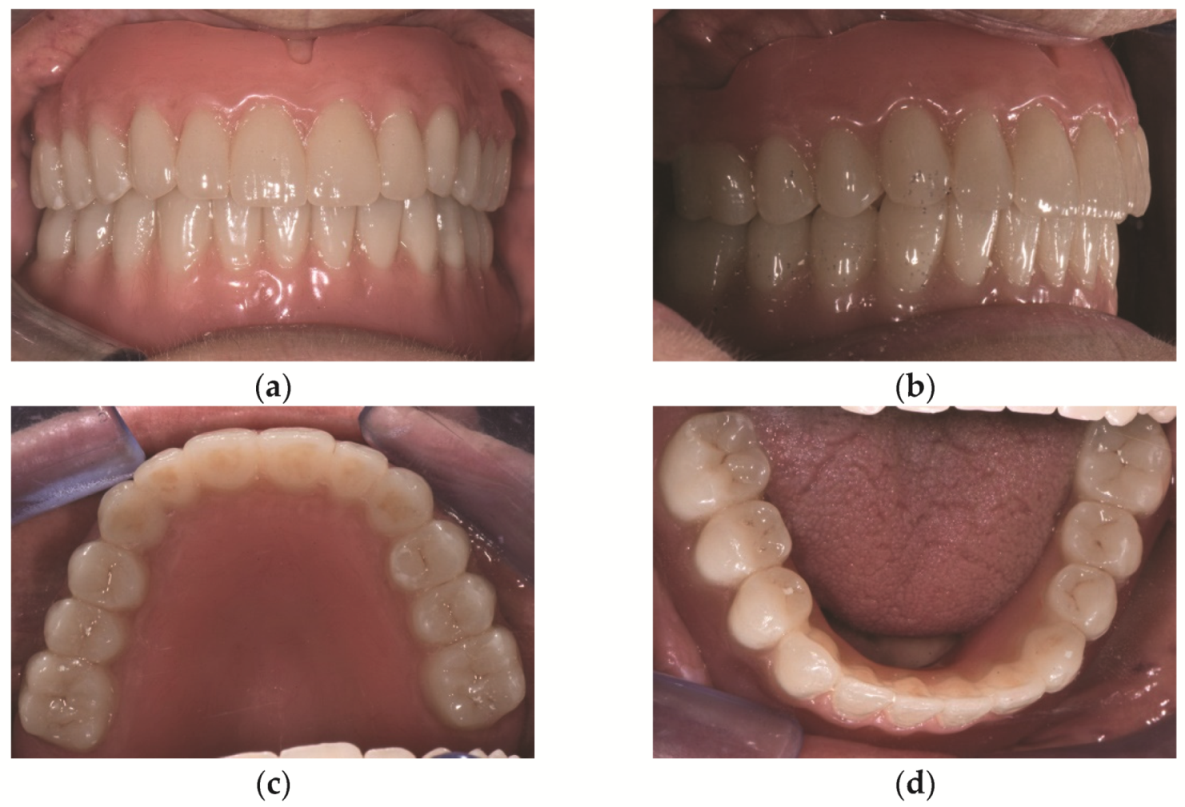 Prosthesis 03 00039 g008