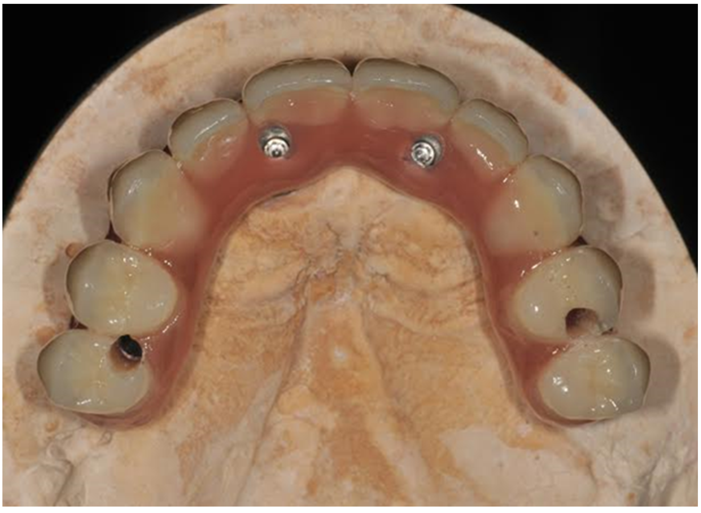 Prosthesis 04 00002 g002