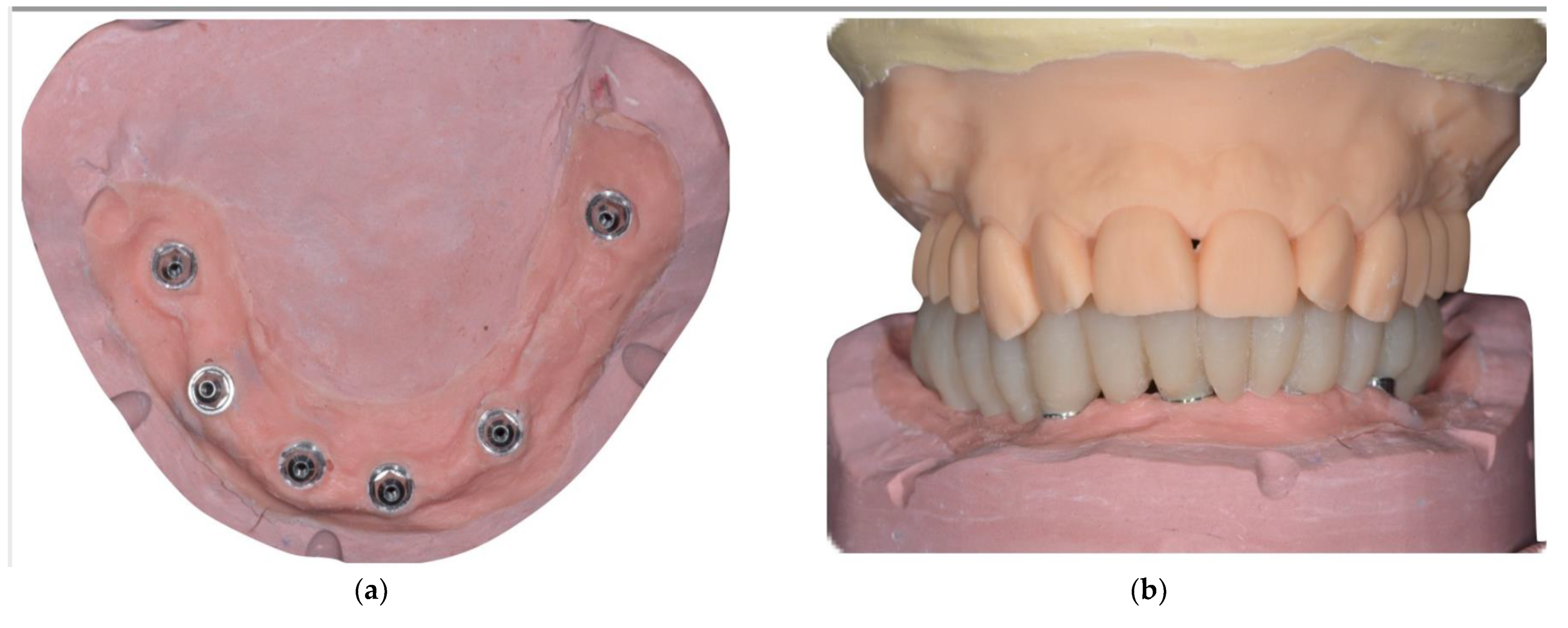 Prosthesis 04 00008 g002 550