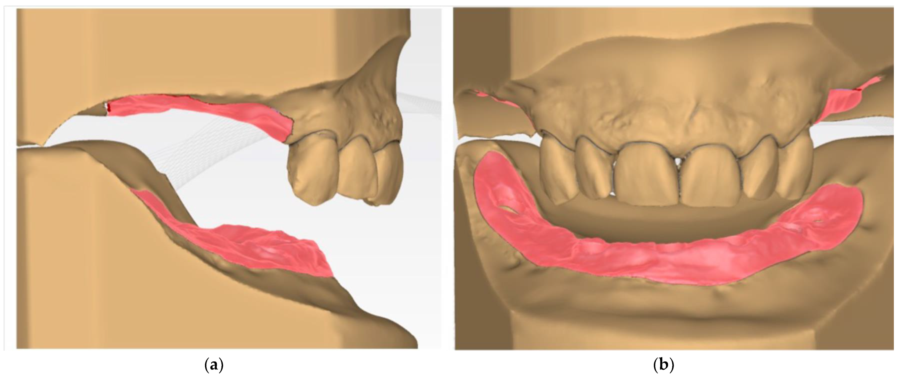 Prosthesis 04 00008 g003 550