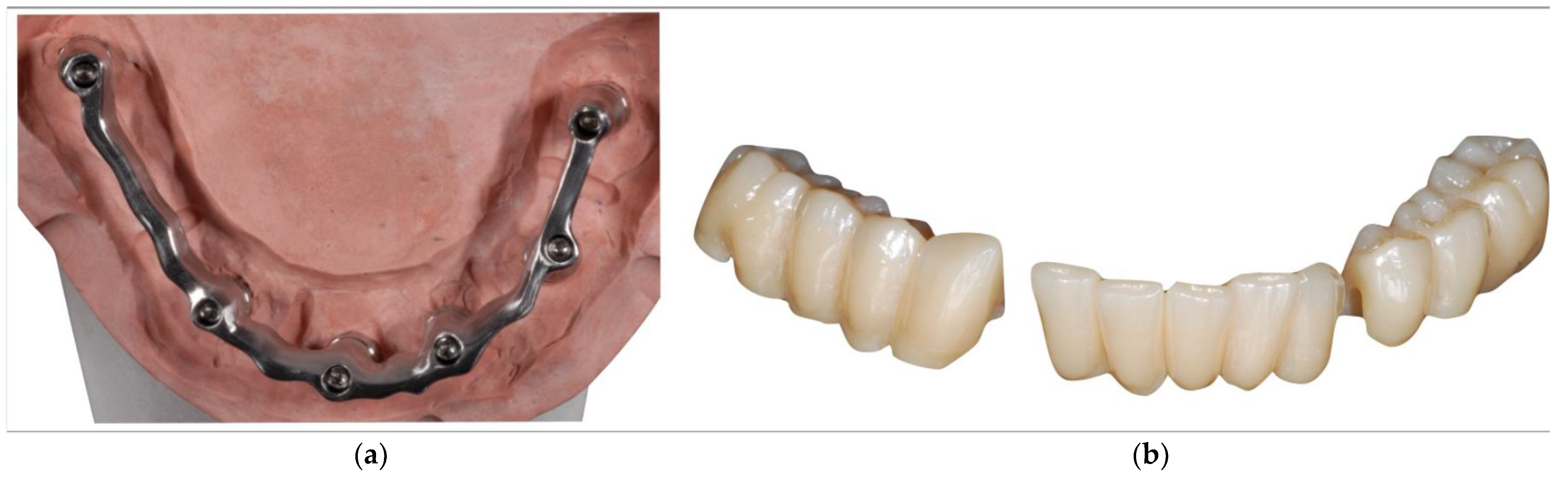 Prosthesis 04 00008 g005 550