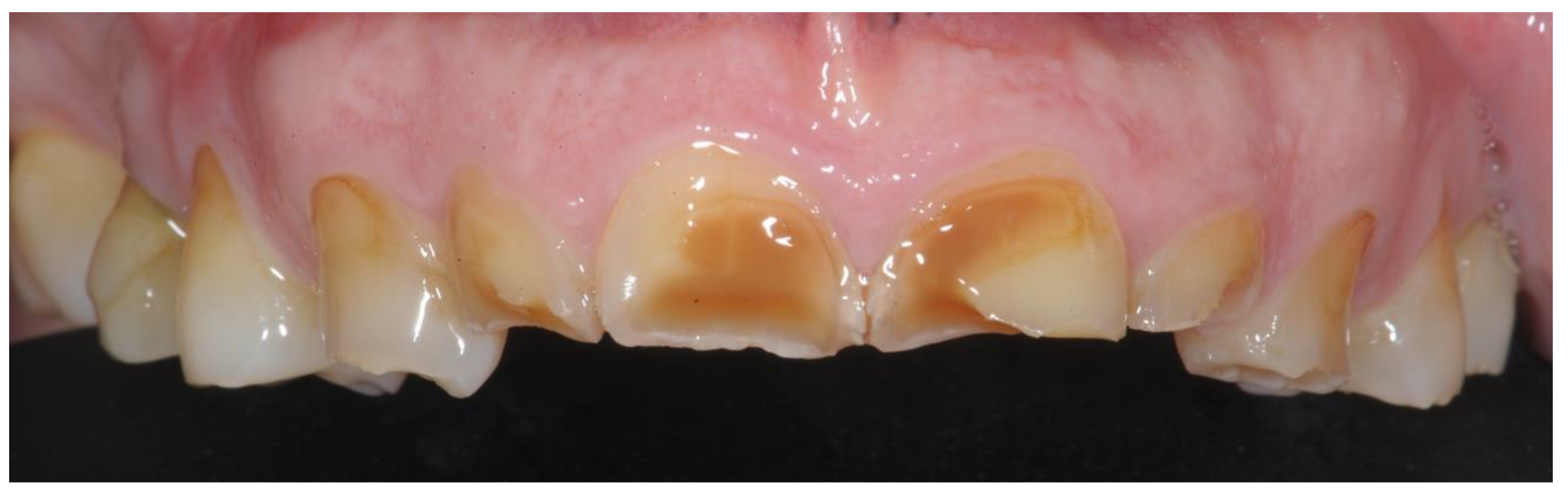 Prosthesis 04 00014 g002