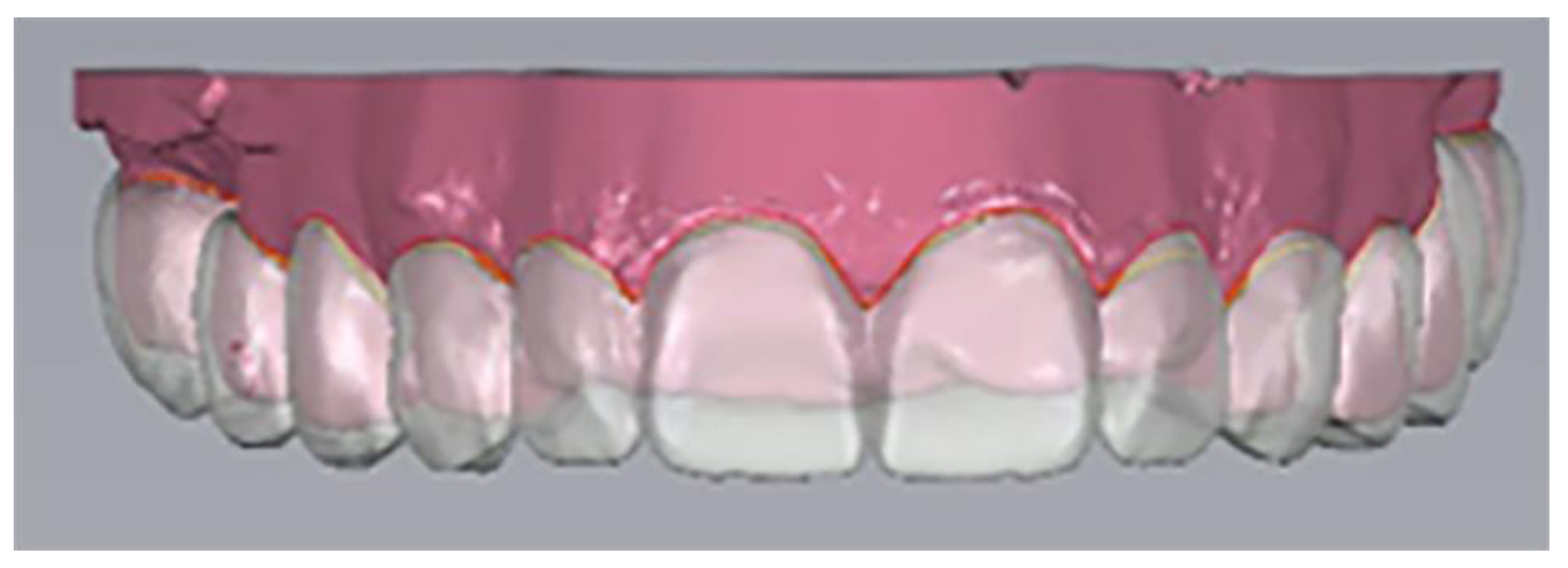 Prosthesis 04 00014 g003