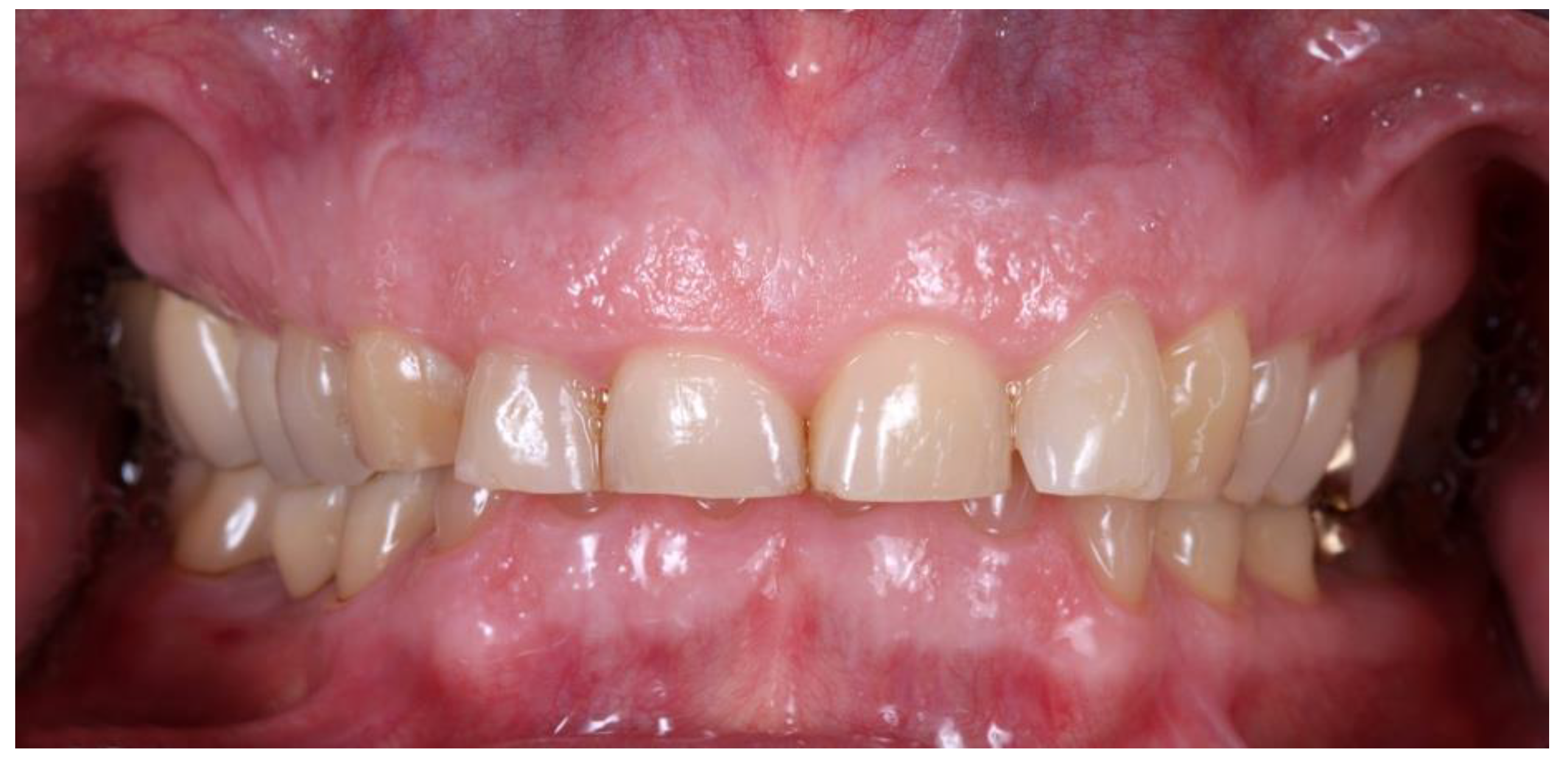 Prosthesis 04 00014 g005