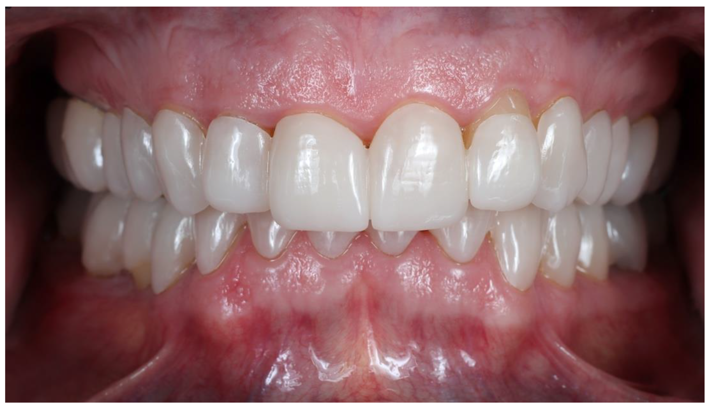 Prosthesis 04 00014 g006