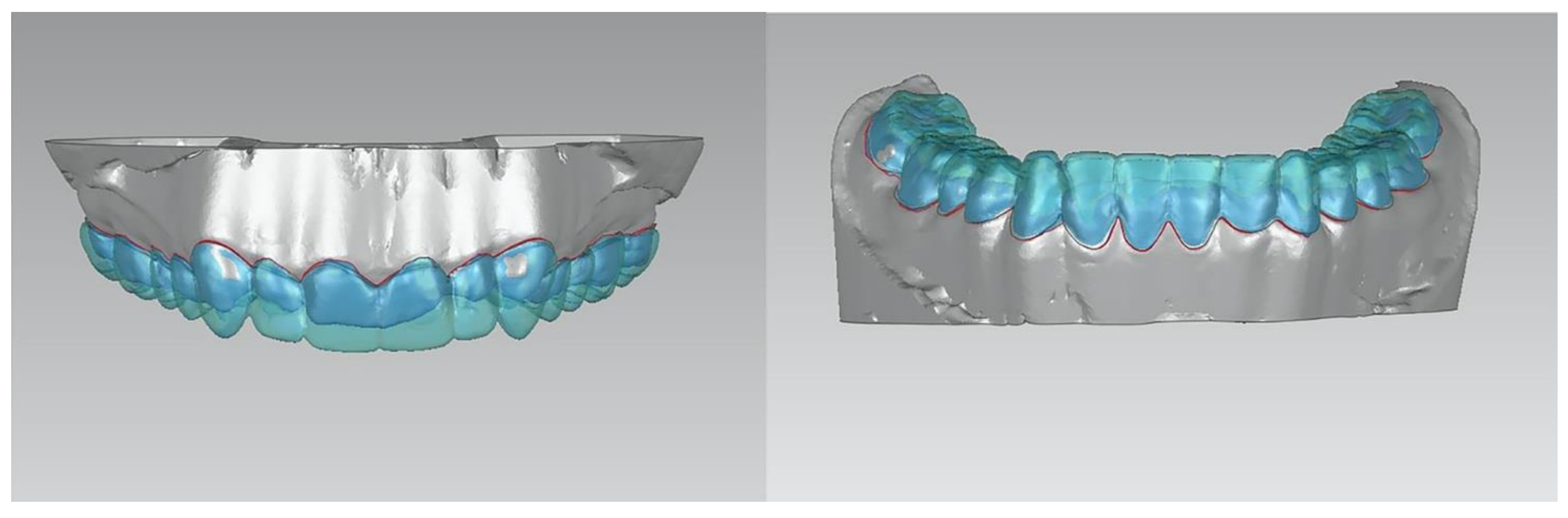 Prosthesis 04 00014 g008