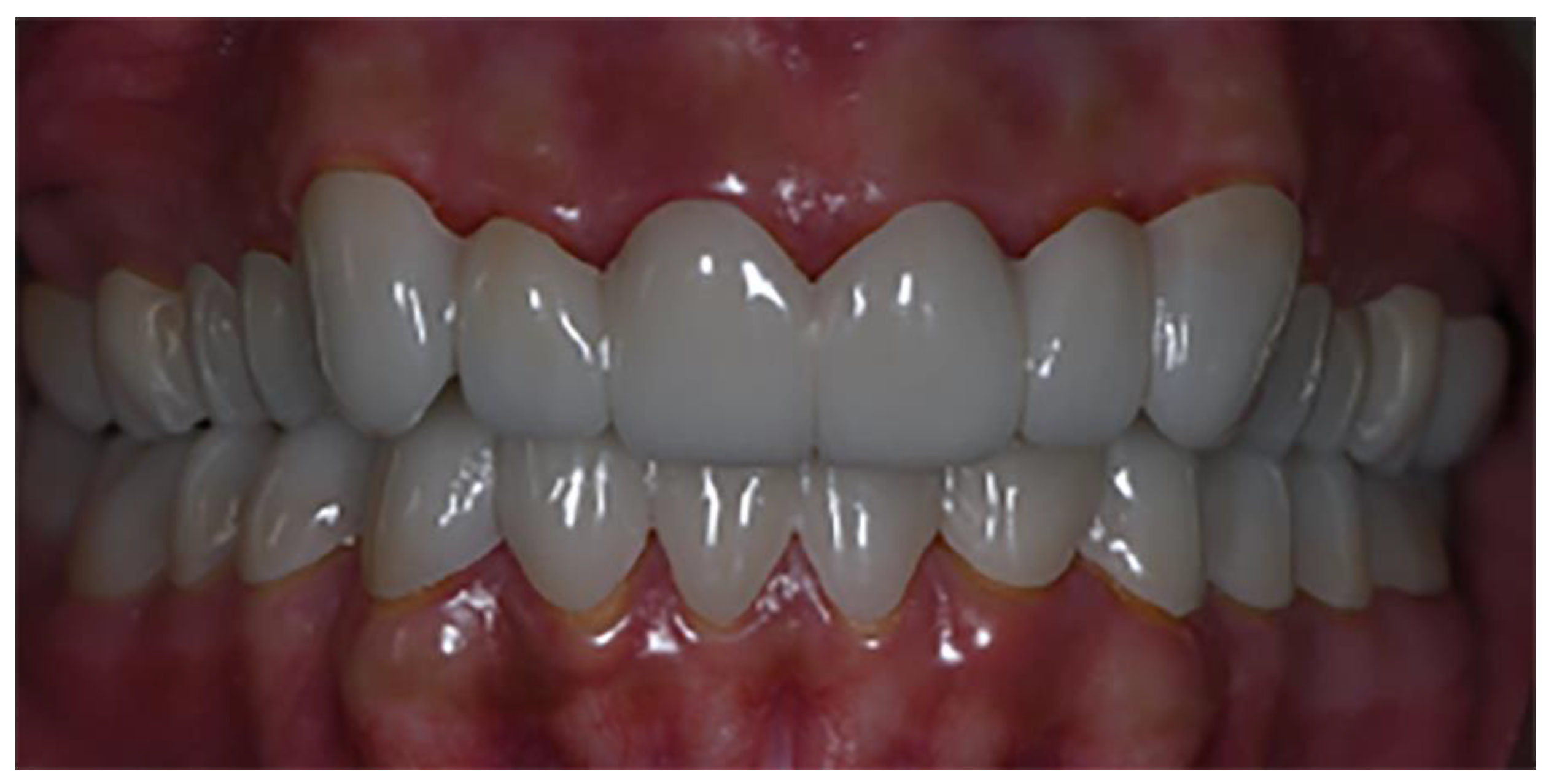 Prosthesis 04 00014 g009