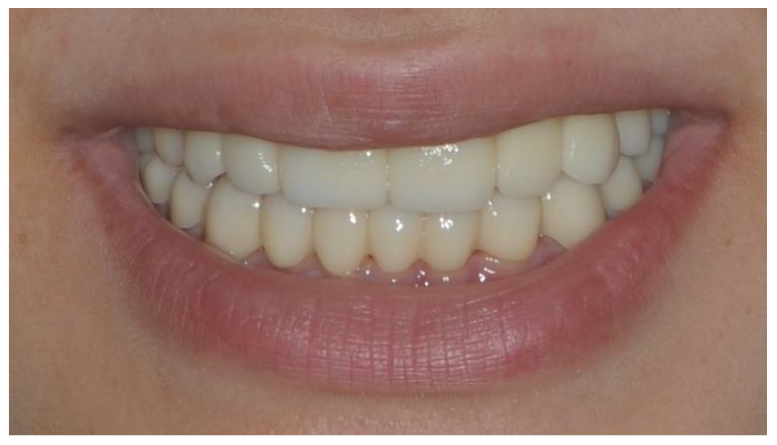 Prosthesis 04 00014 g014