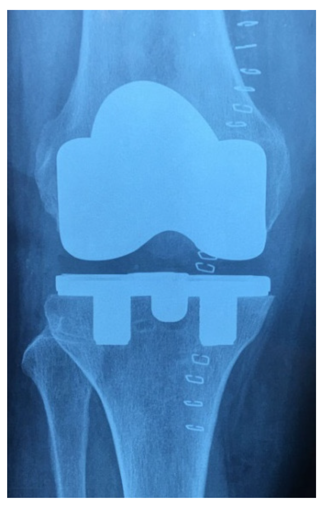 Prosthesis 04 00016 g003 550