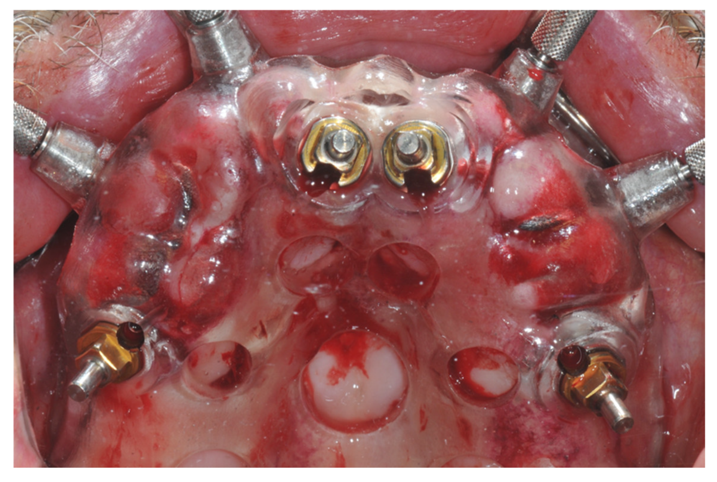 Prosthesis 04 00020 g004 550