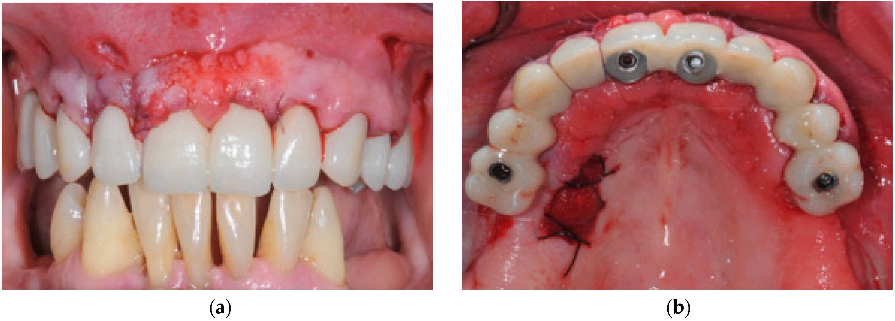 Prosthesis 04 00020 g005 550