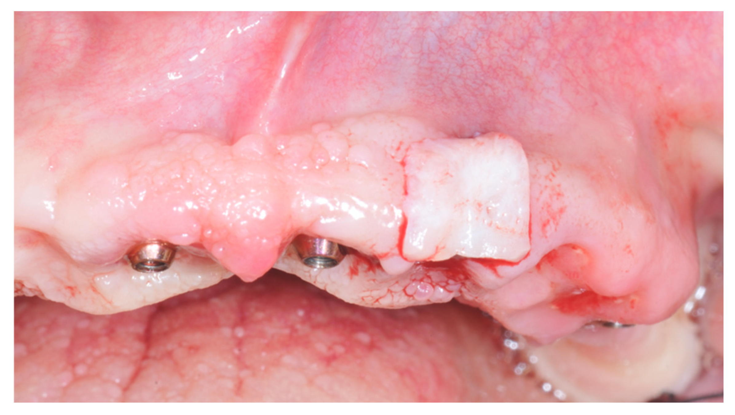 Prosthesis 04 00020 g006 550