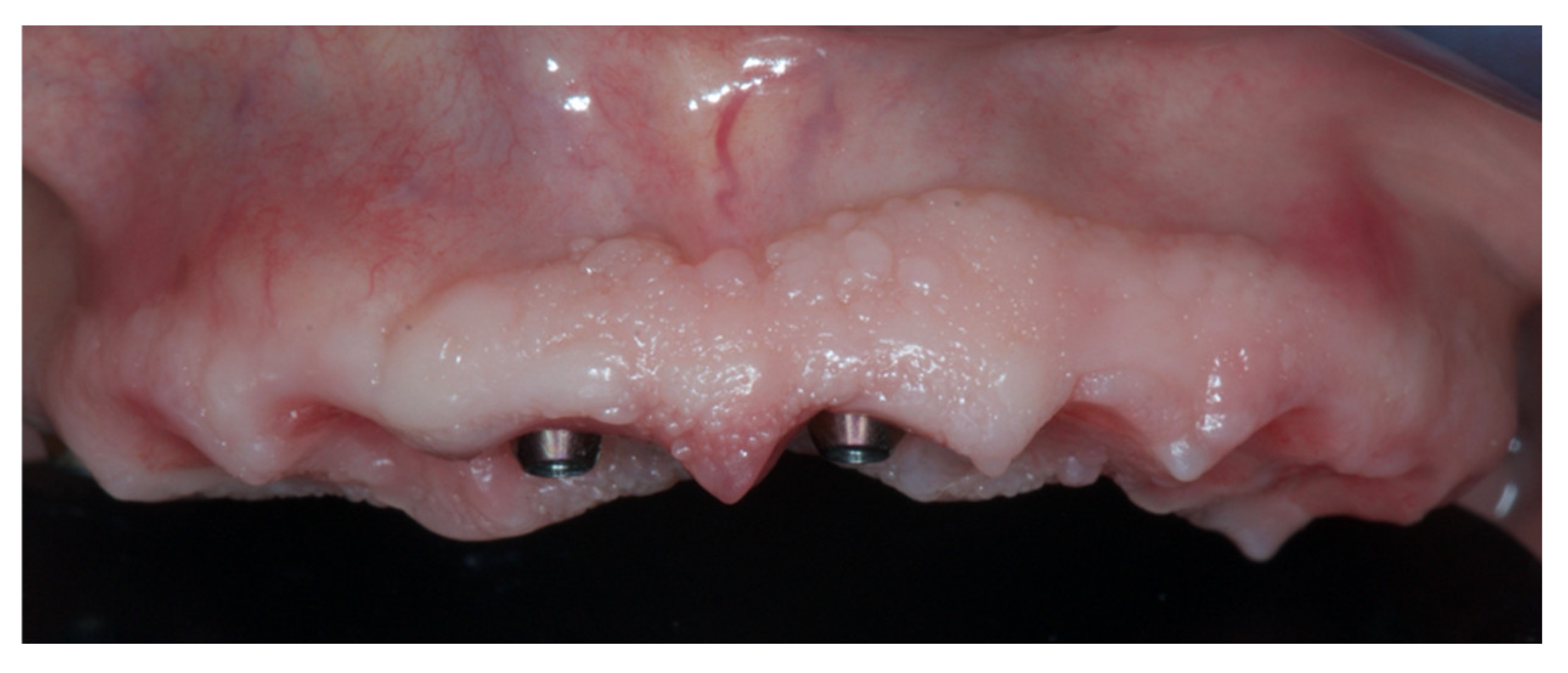 Prosthesis 04 00020 g007 550