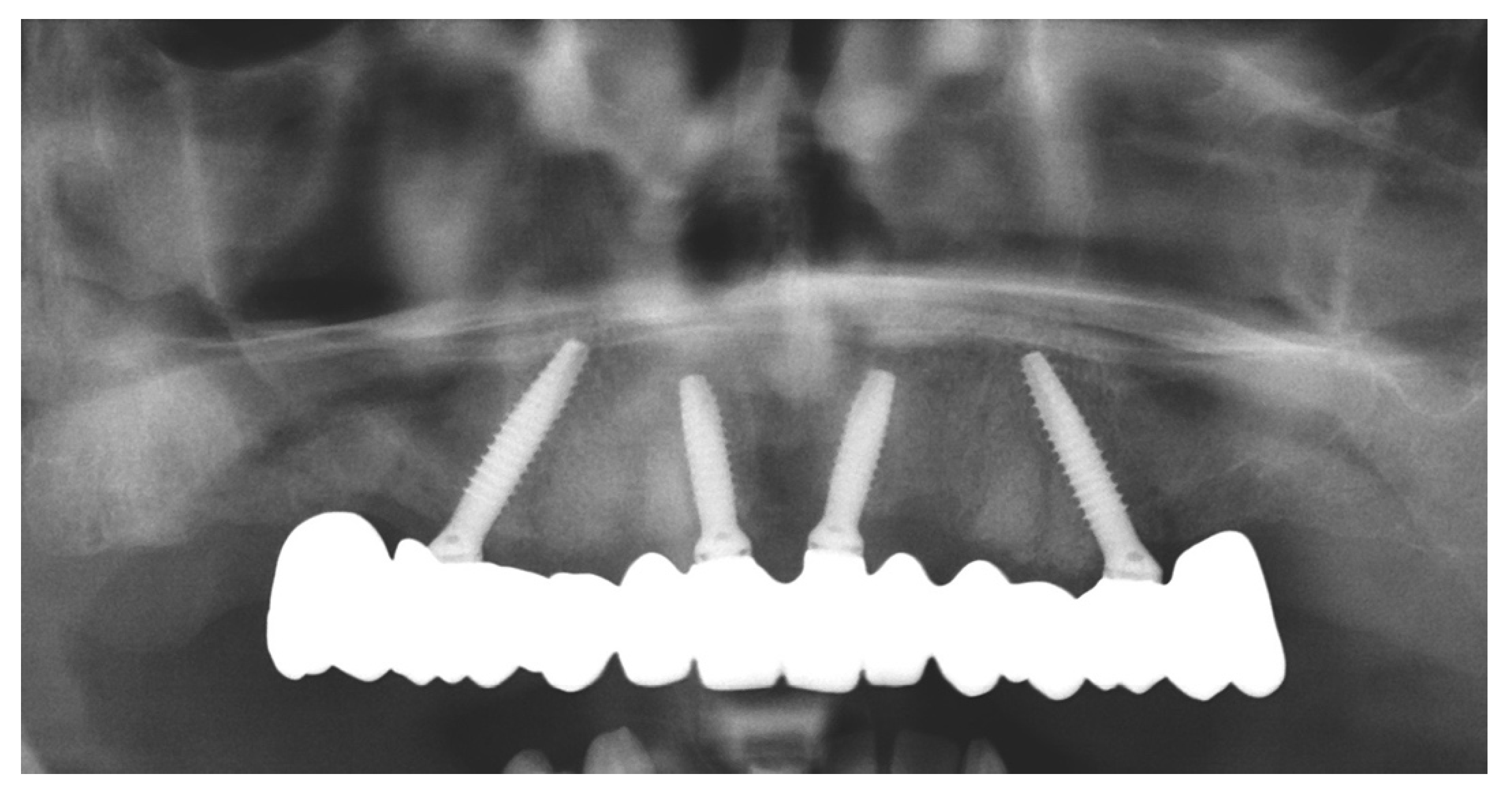 Prosthesis 04 00020 g009 550