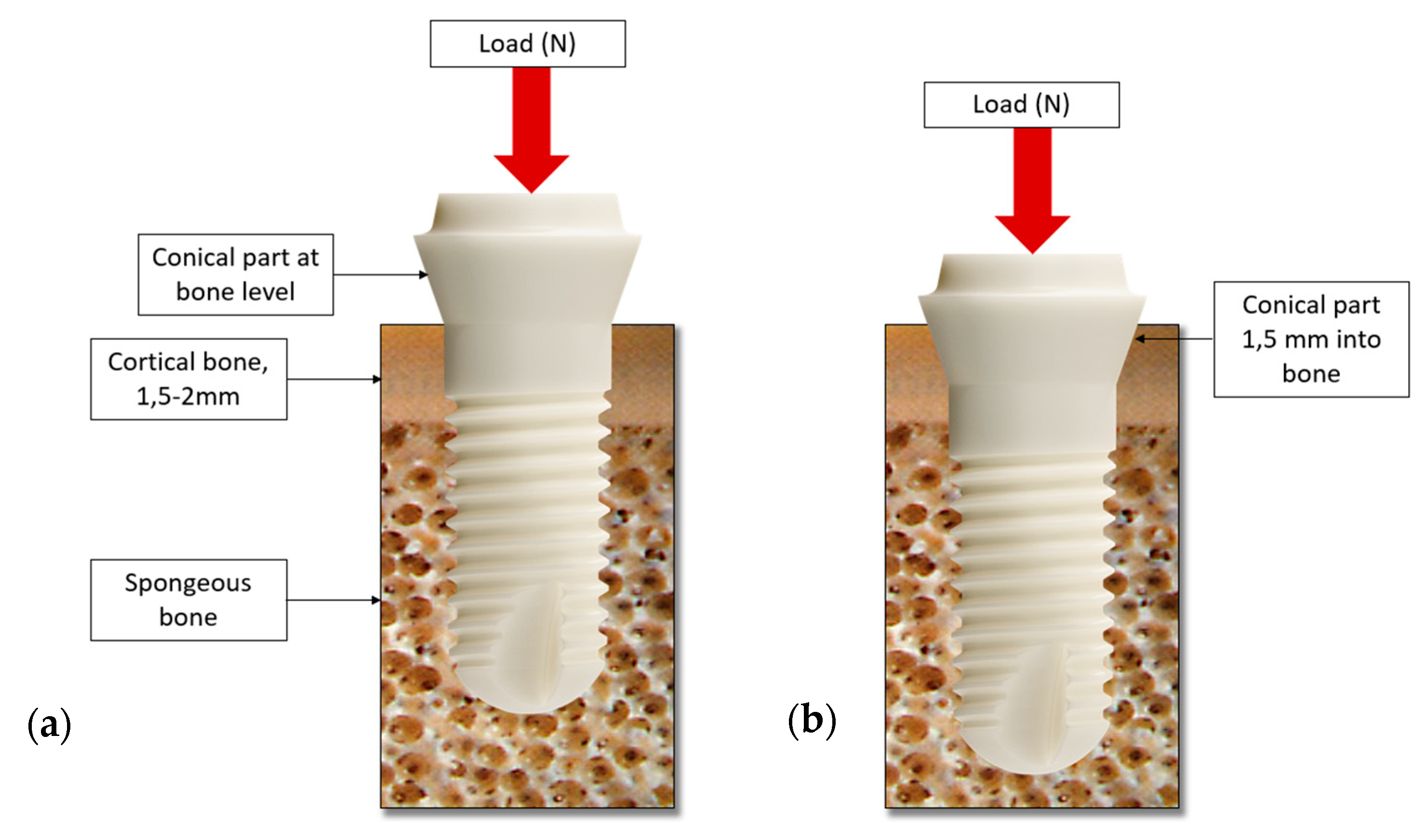 Prosthesis 04 00040 g001