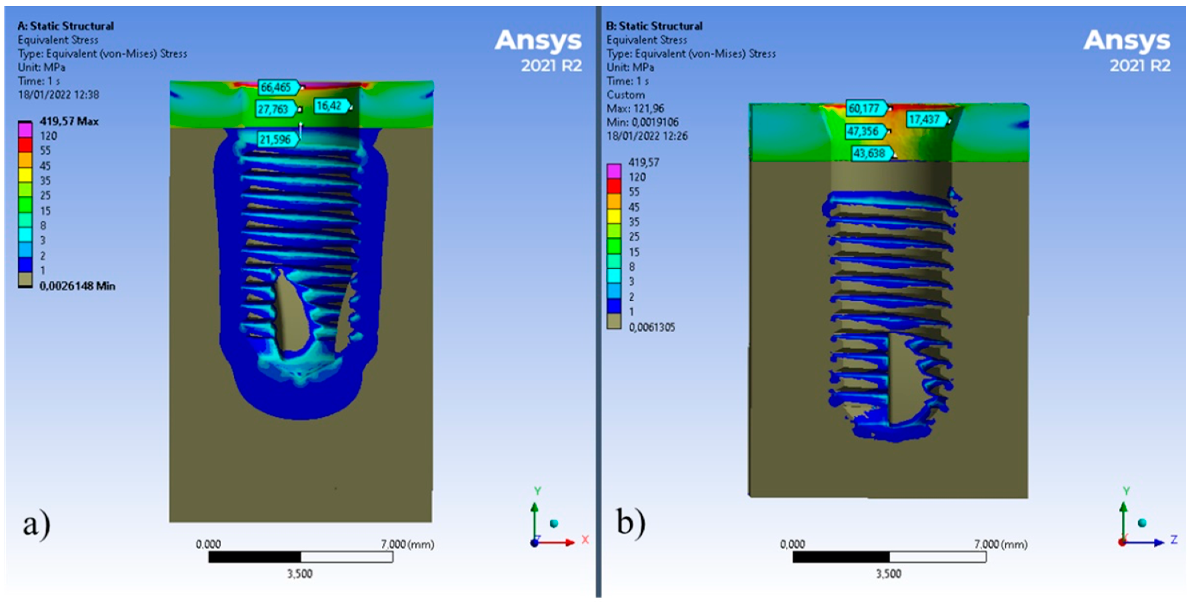Prosthesis 04 00040 g005