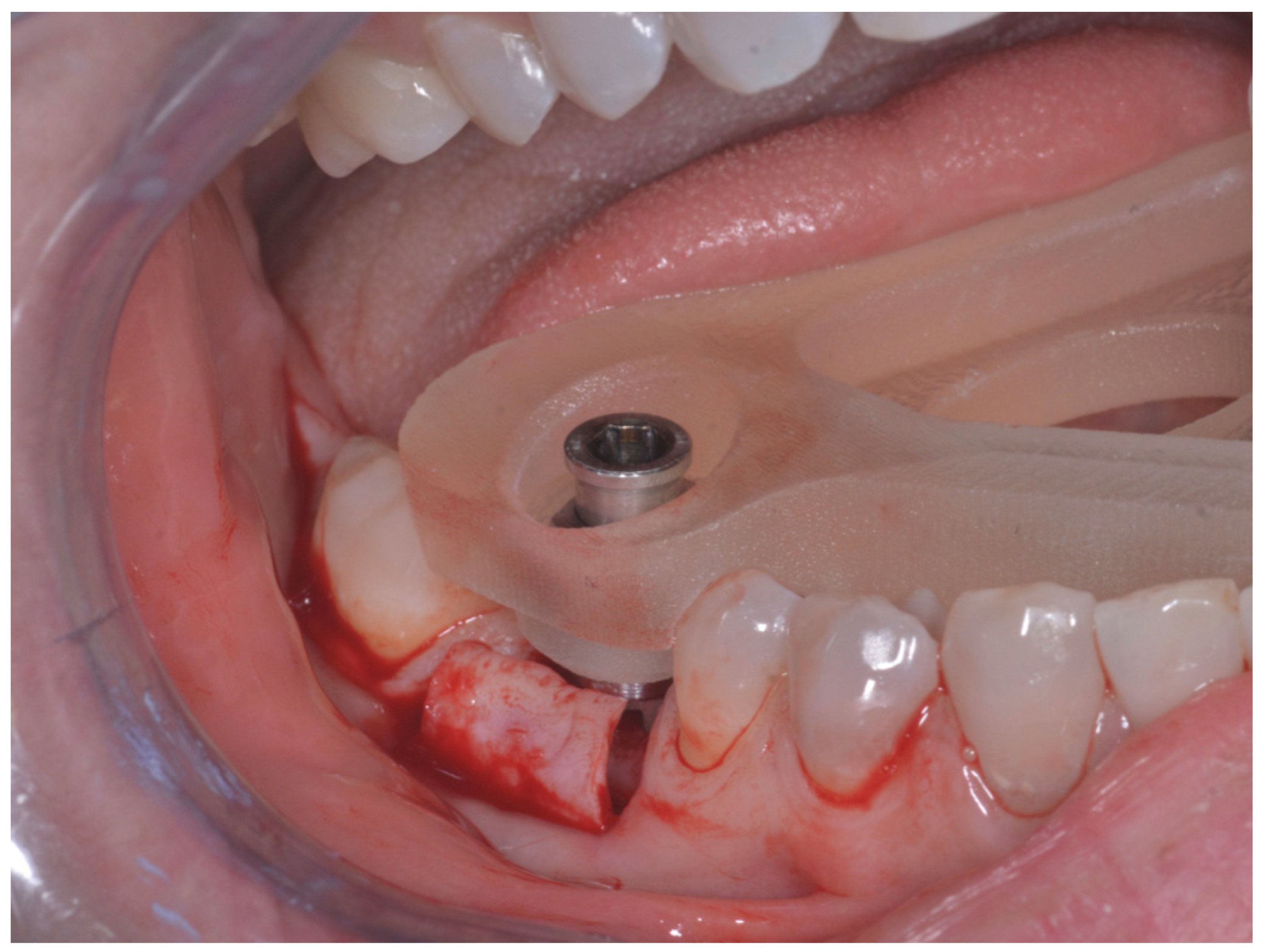 Prosthesis 04 00043 g007