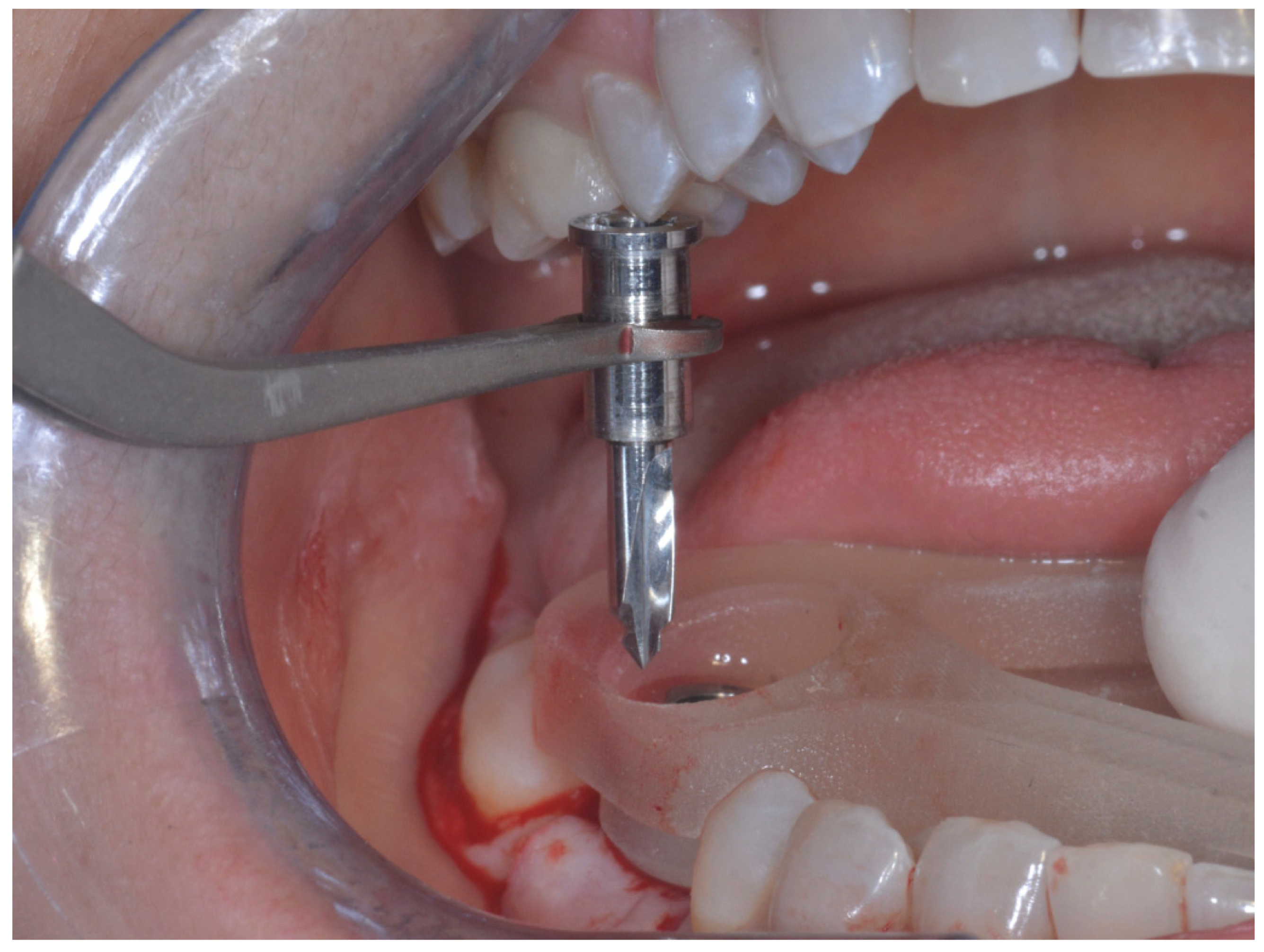 Prosthesis 04 00043 g011