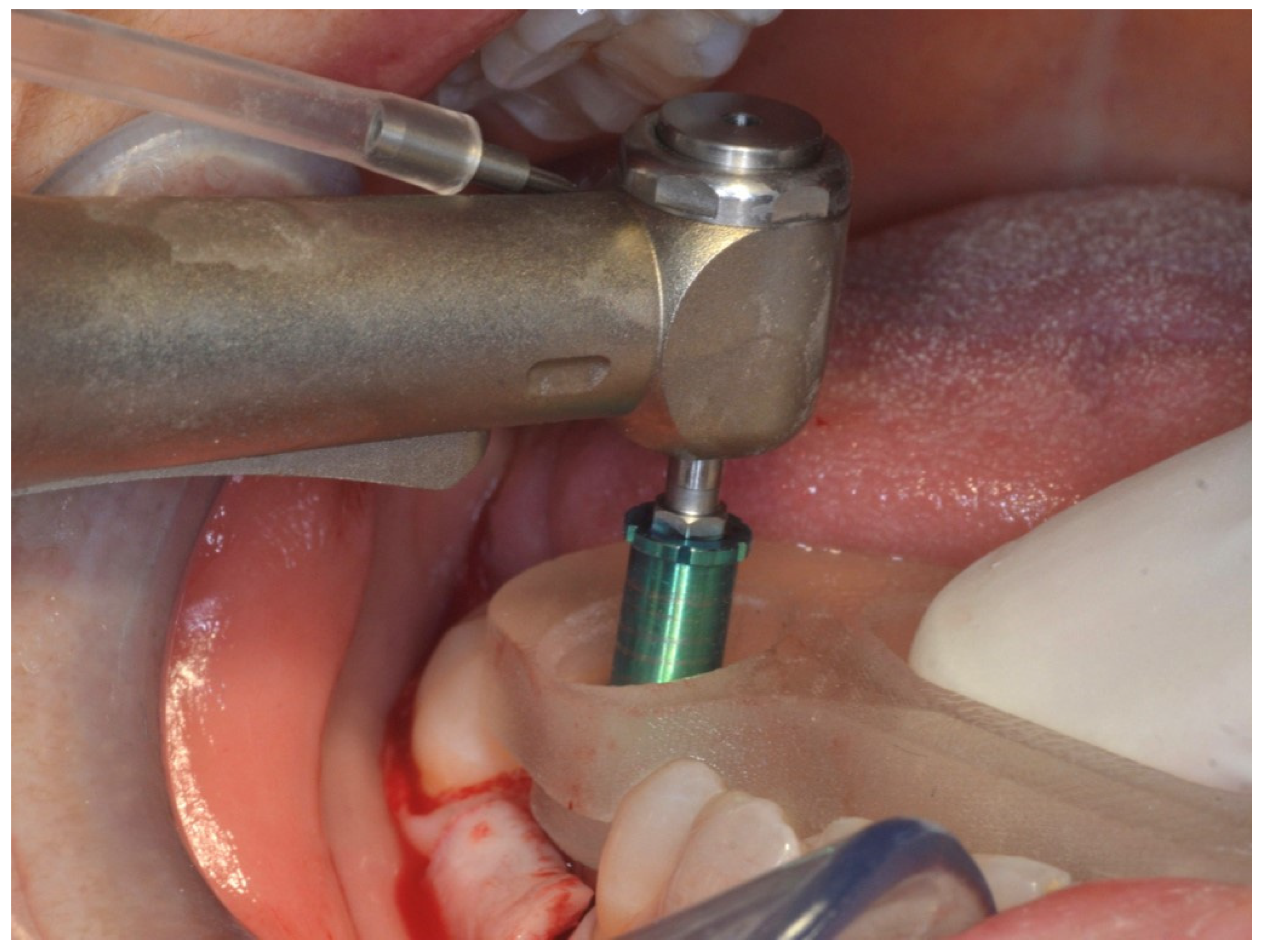 Prosthesis 04 00043 g014