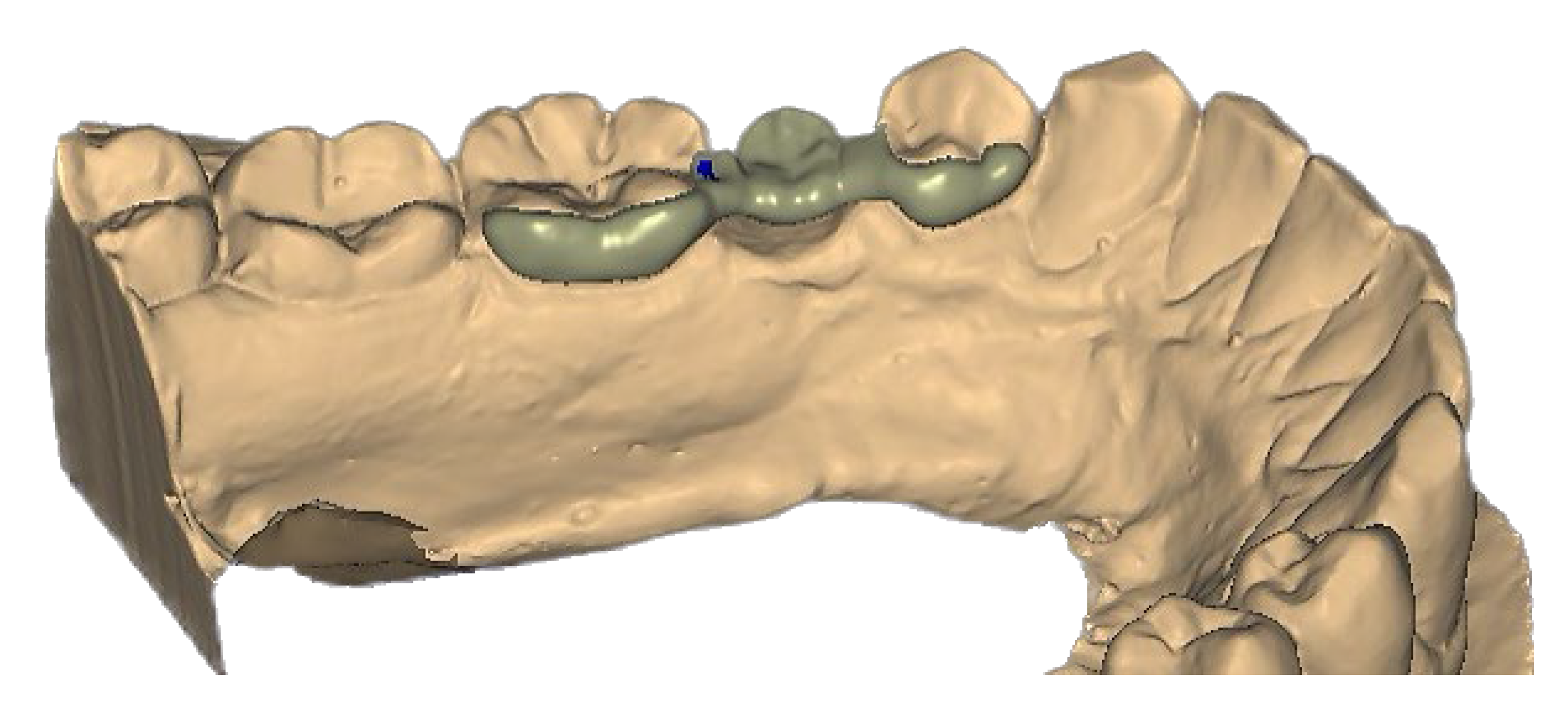 Prosthesis 04 00047 g001 Prosthesis 04 00047 g001