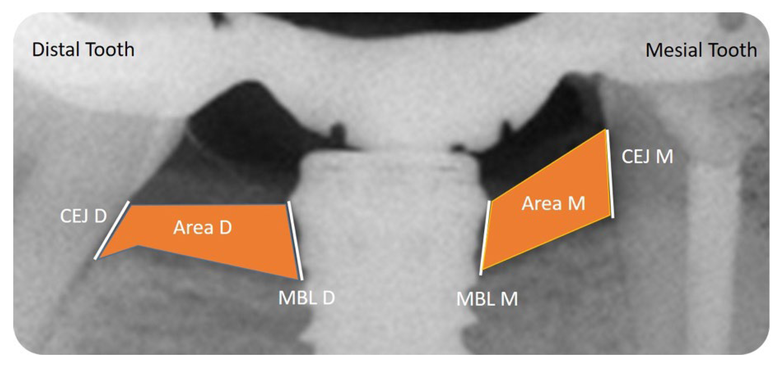 Prosthesis 04 00047 g002 Prosthesis 04 00047 g002