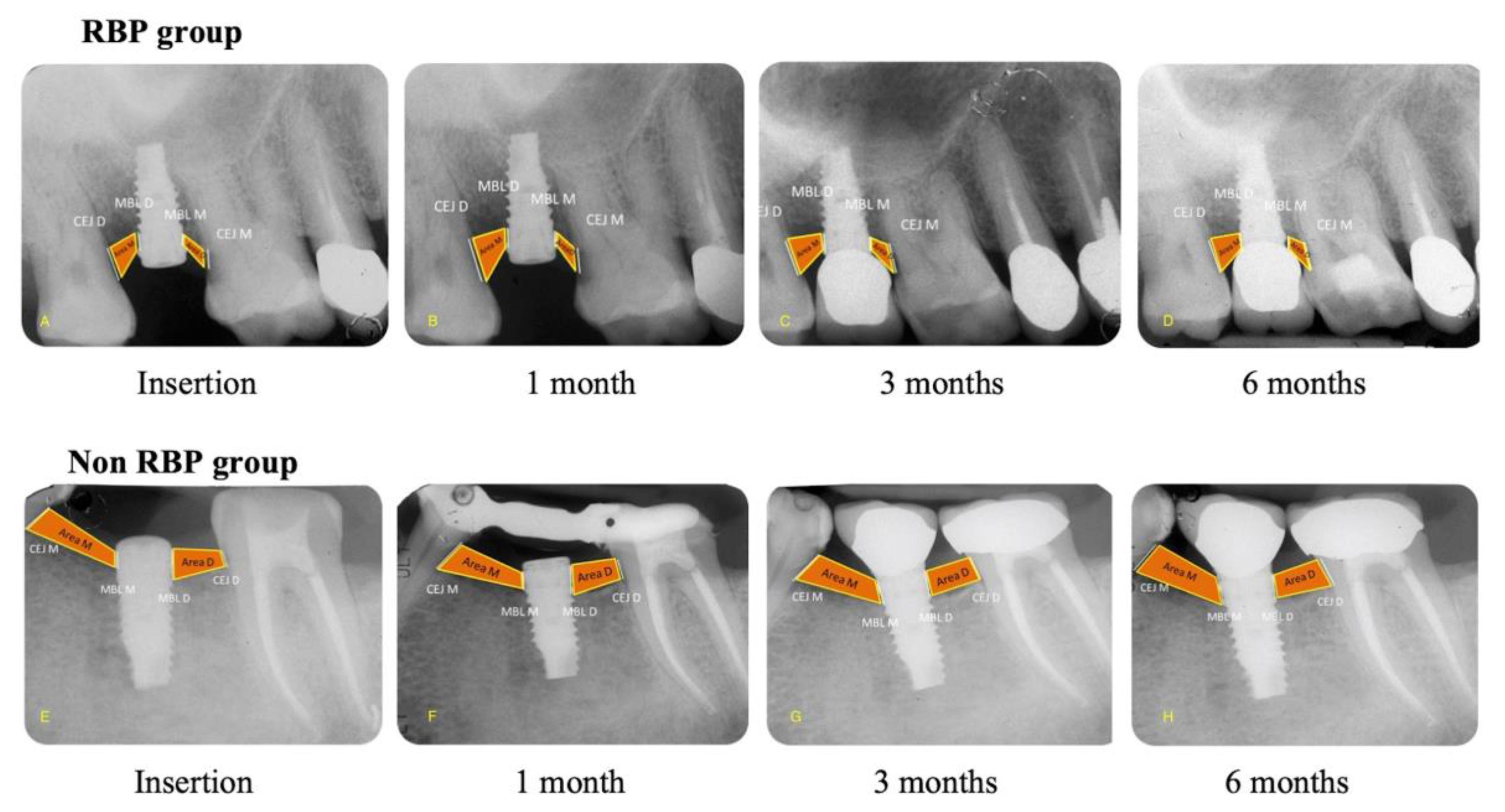 Prosthesis 04 00047 g004 Prosthesis 04 00047 g004