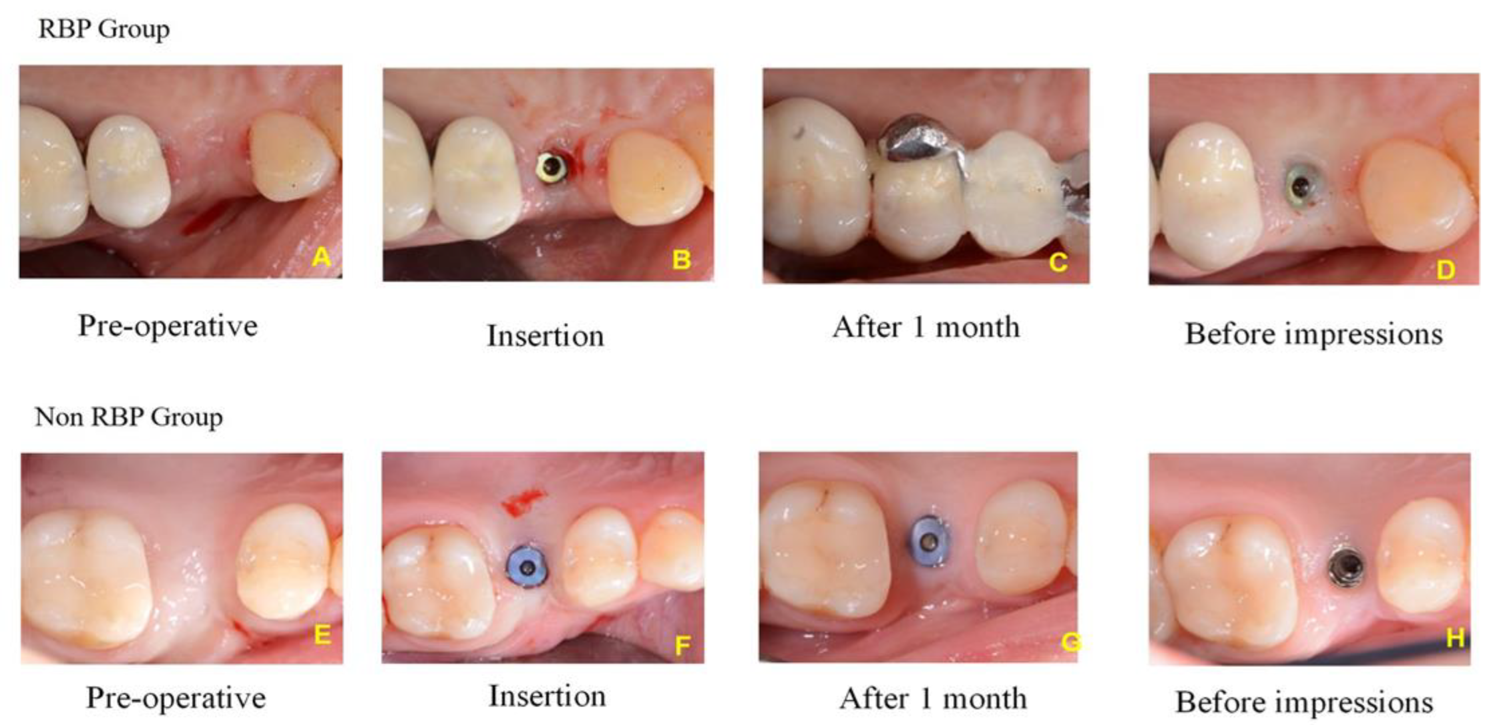 Prosthesis 04 00047 g005 Prosthesis 04 00047 g005