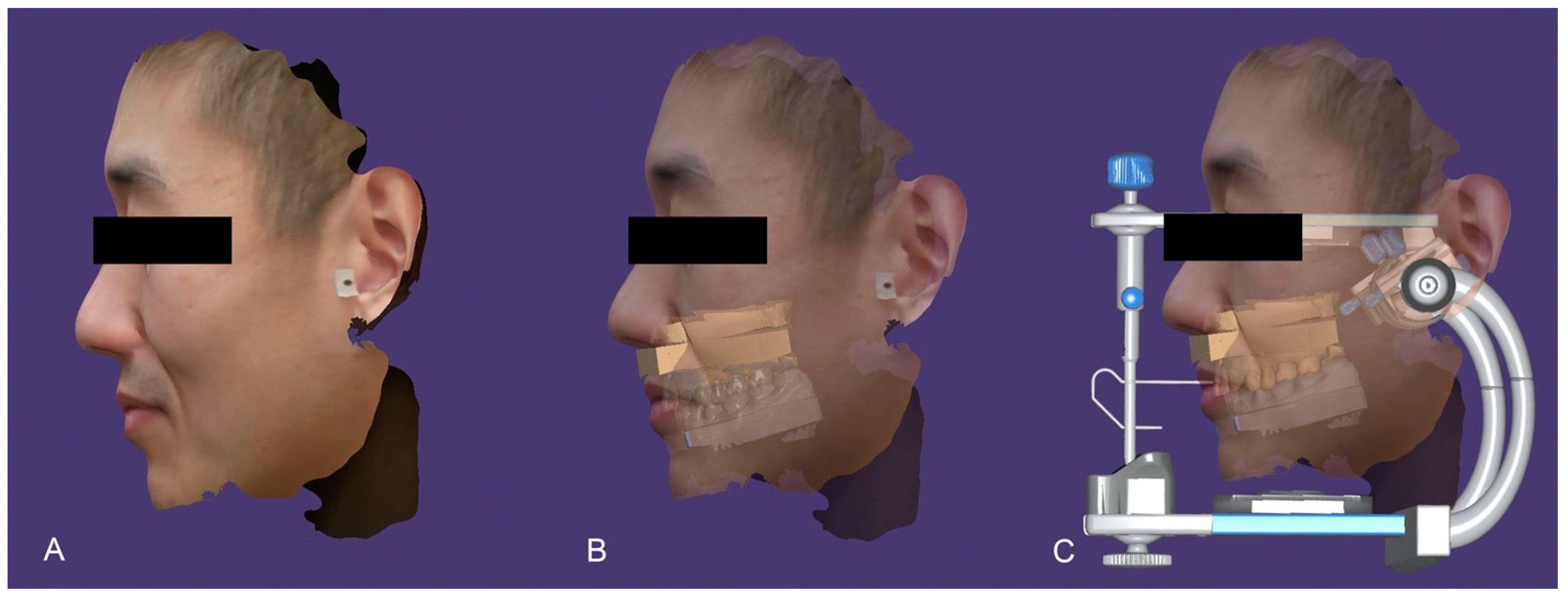 Prosthesis Free FullText Facial Scanners in Dentistry An Overview
