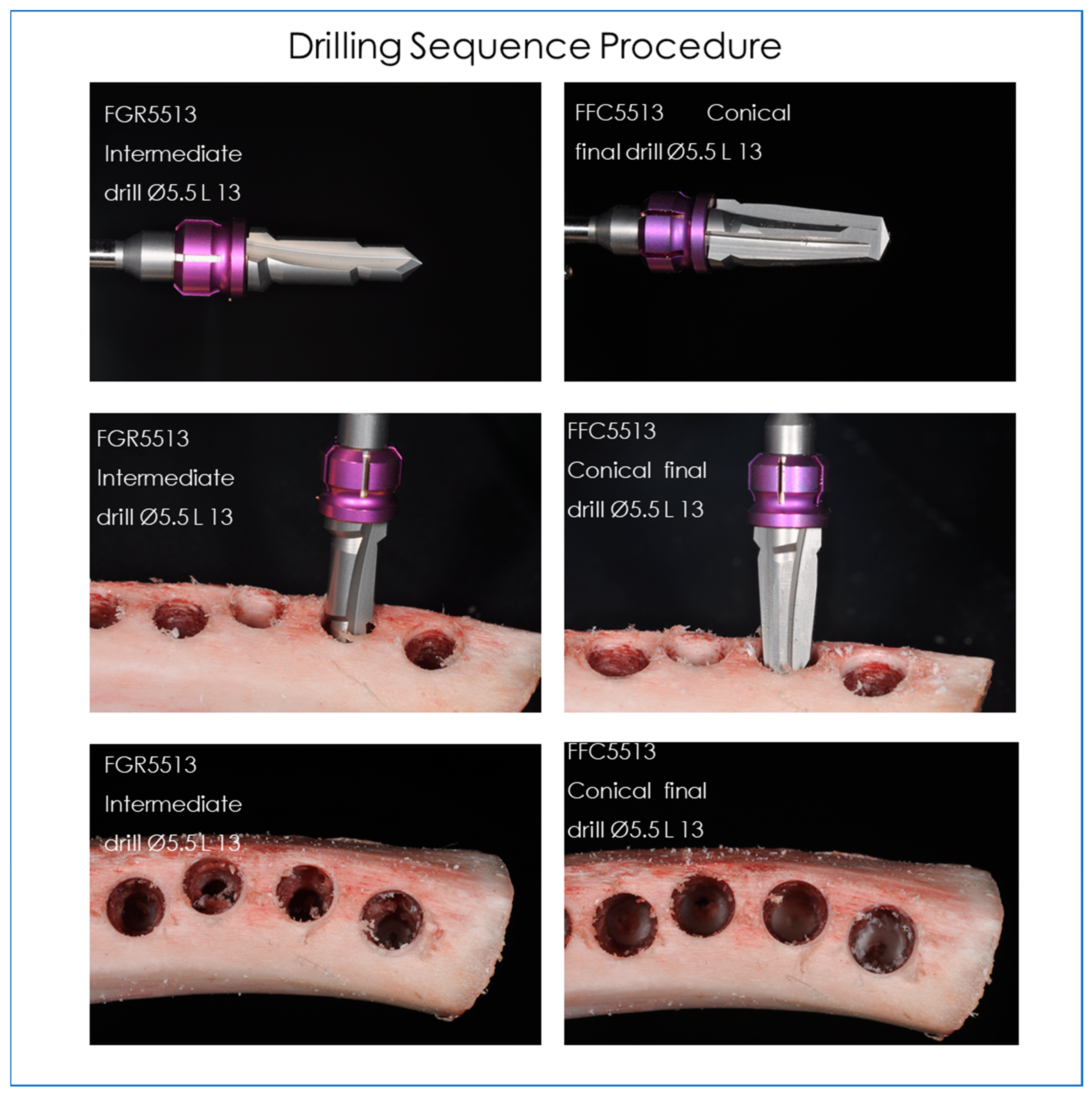 Prosthesis 04 00054 g003