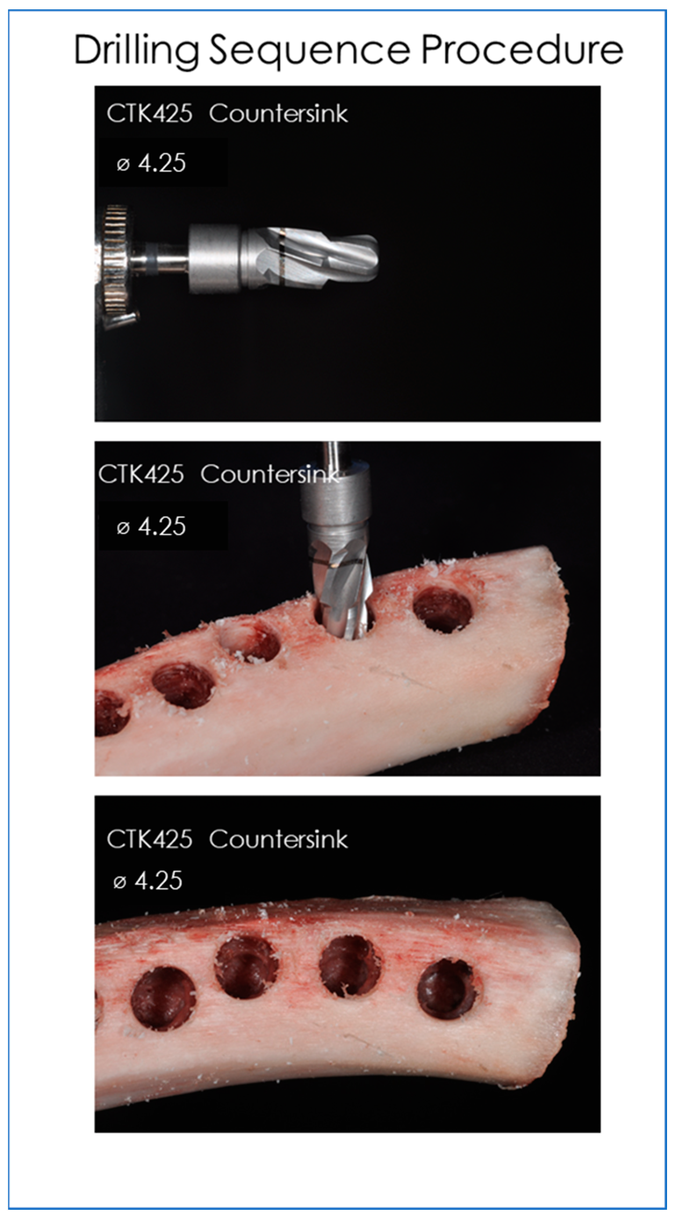 Prosthesis 04 00054 g004