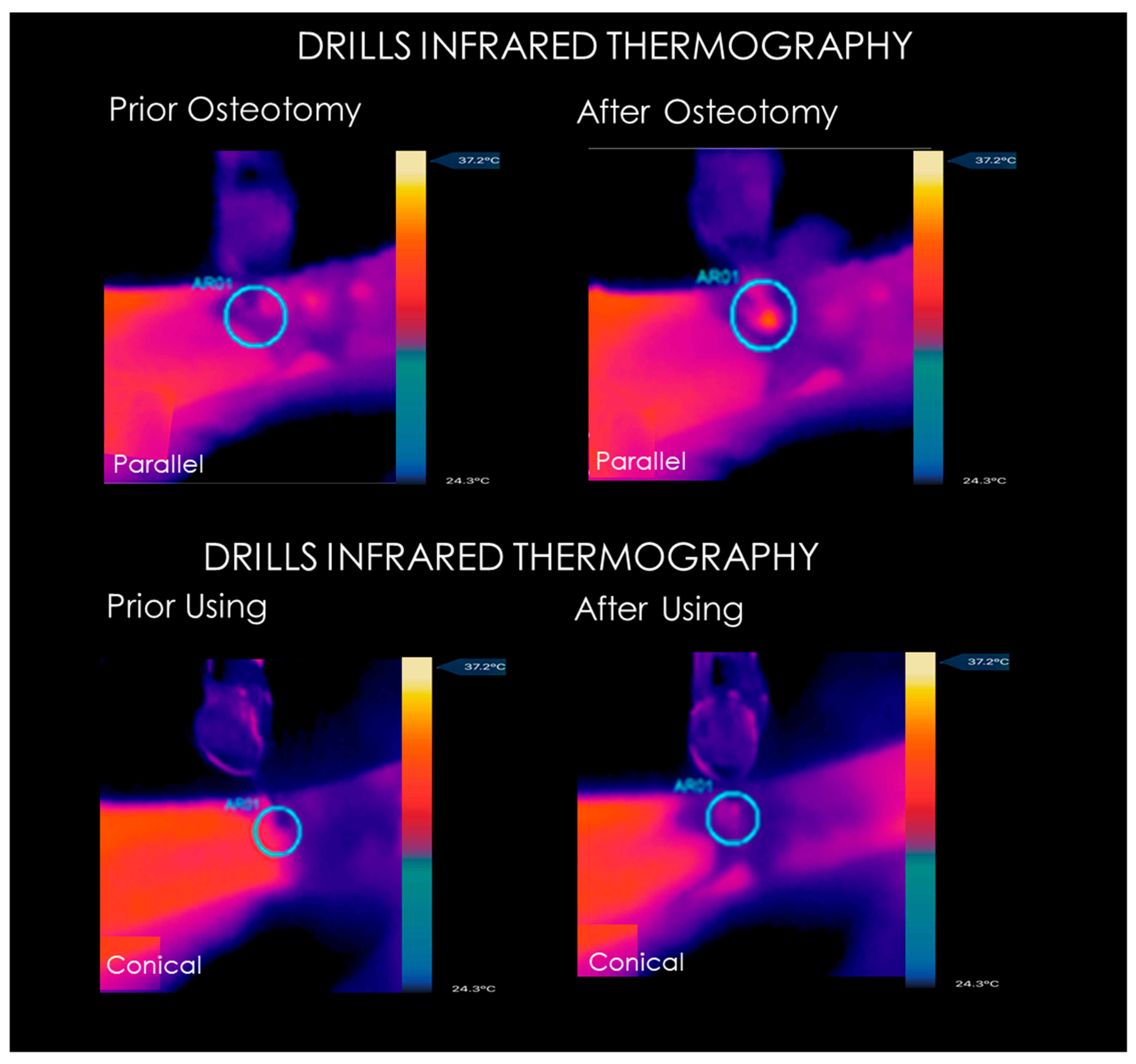 Prosthesis 04 00054 g007