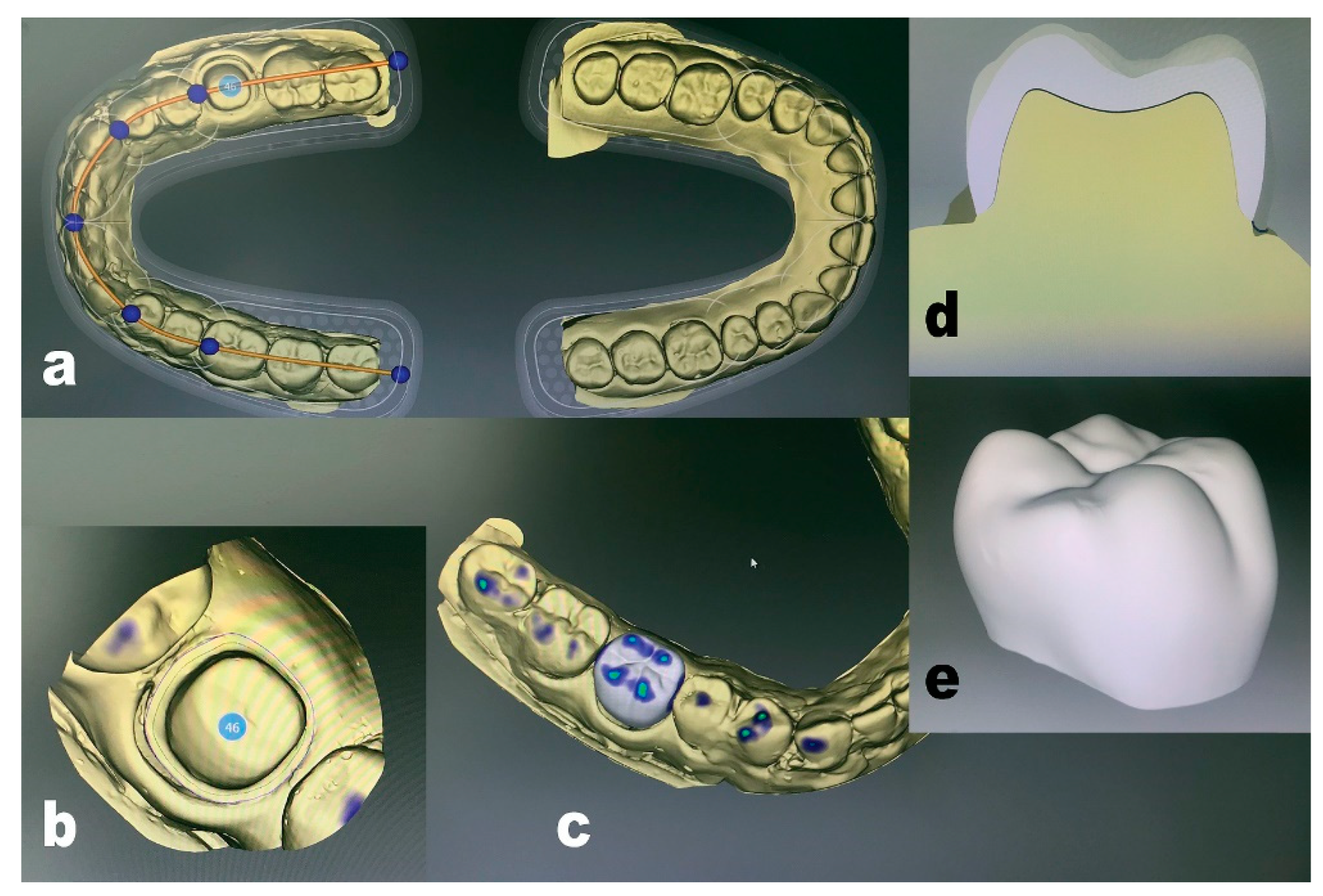 Prosthesis 05 00003 g002