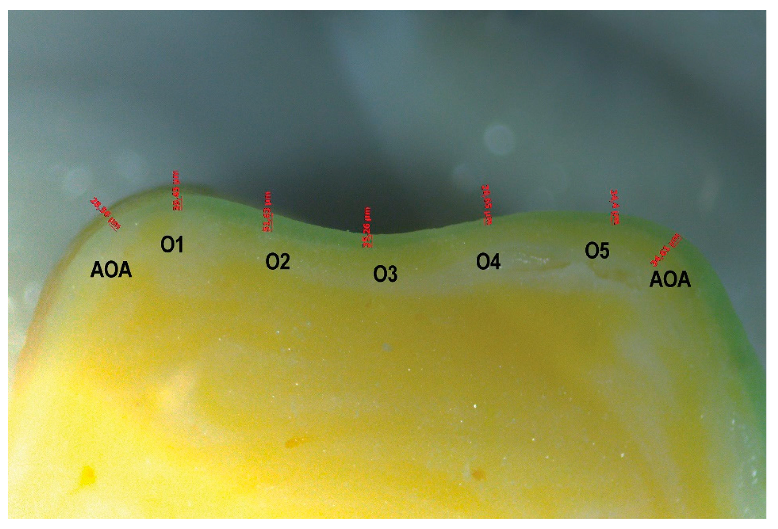 Prosthesis 05 00003 g004