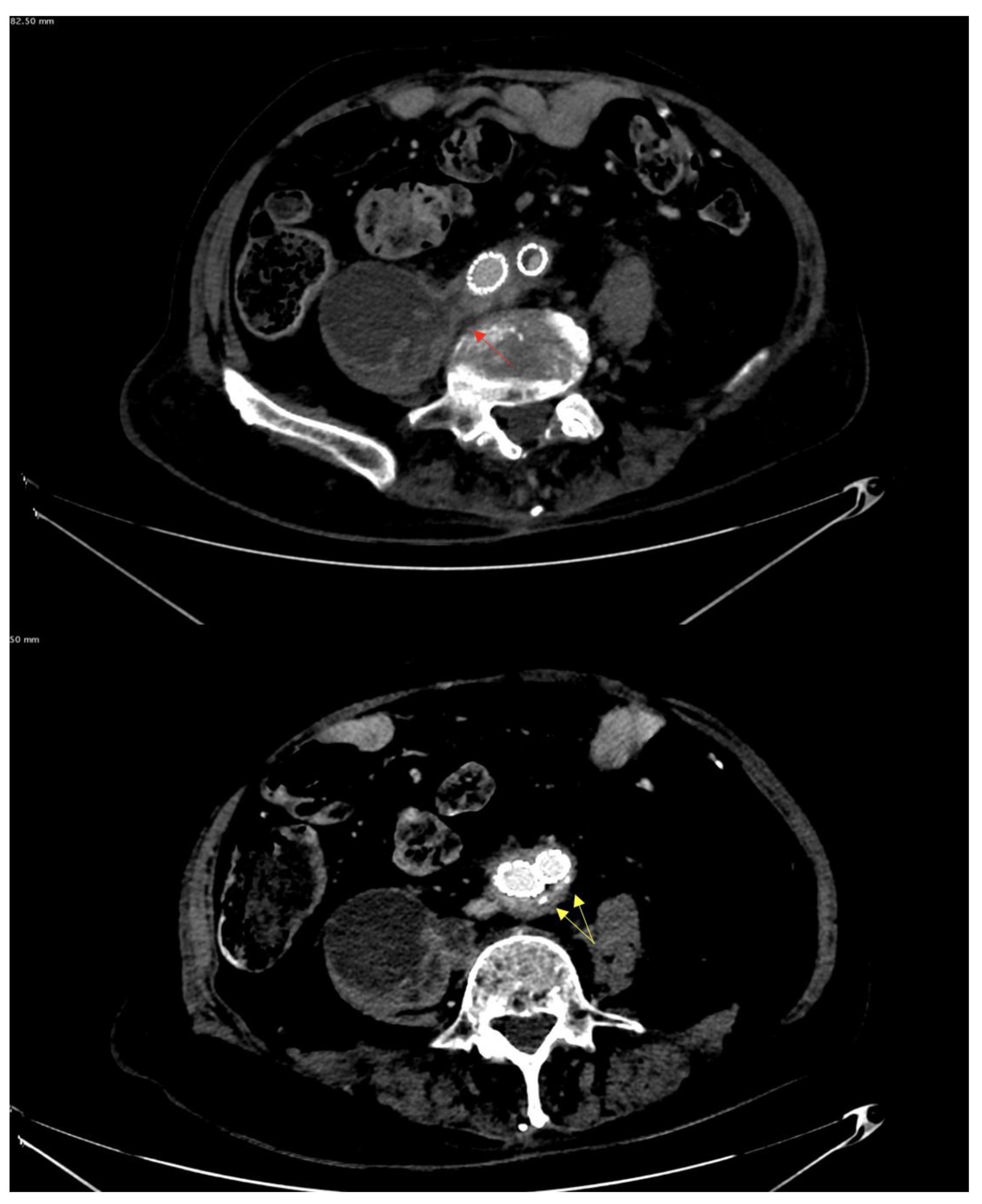 Prosthesis 05 00012 g002 Prosthesis 05 00012 g002