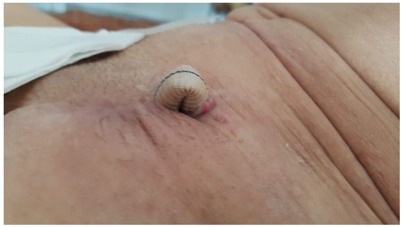 Prosthesis 05 00012 g003 Prosthesis 05 00012 g003