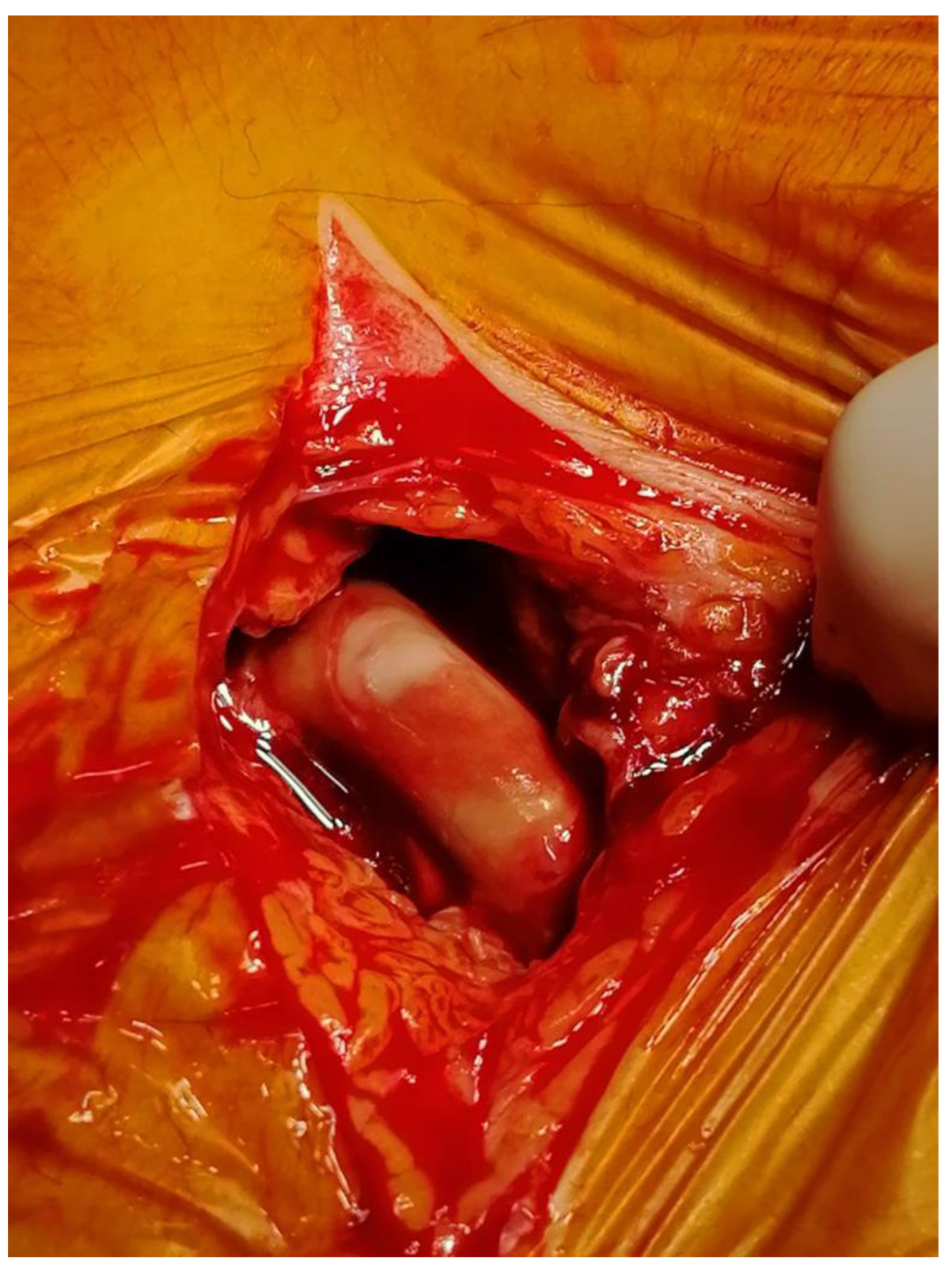 Prosthesis 05 00012 g004 Prosthesis 05 00012 g004