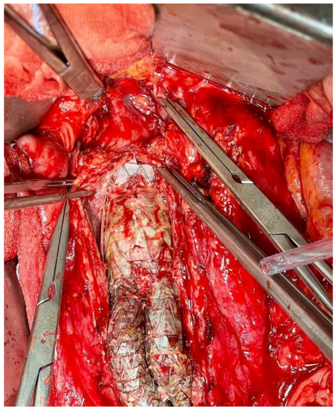 Prosthesis 05 00012 g005 Prosthesis 05 00012 g005