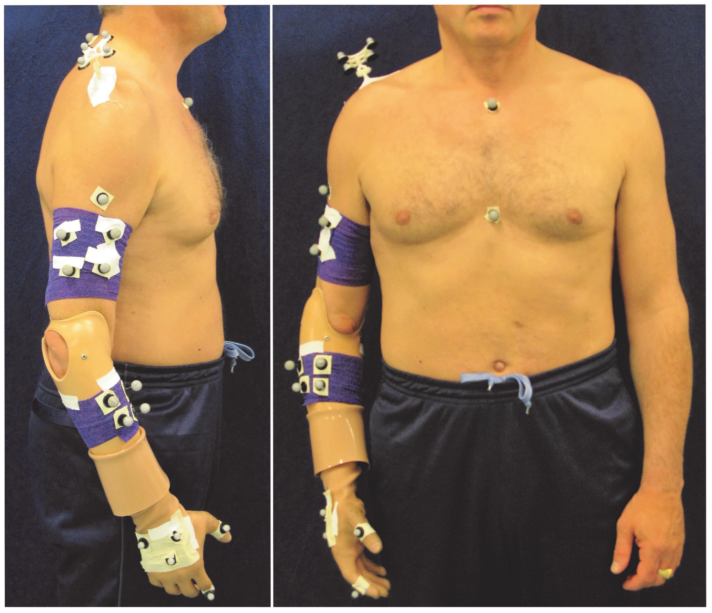 Prosthesis 05 00014 g003