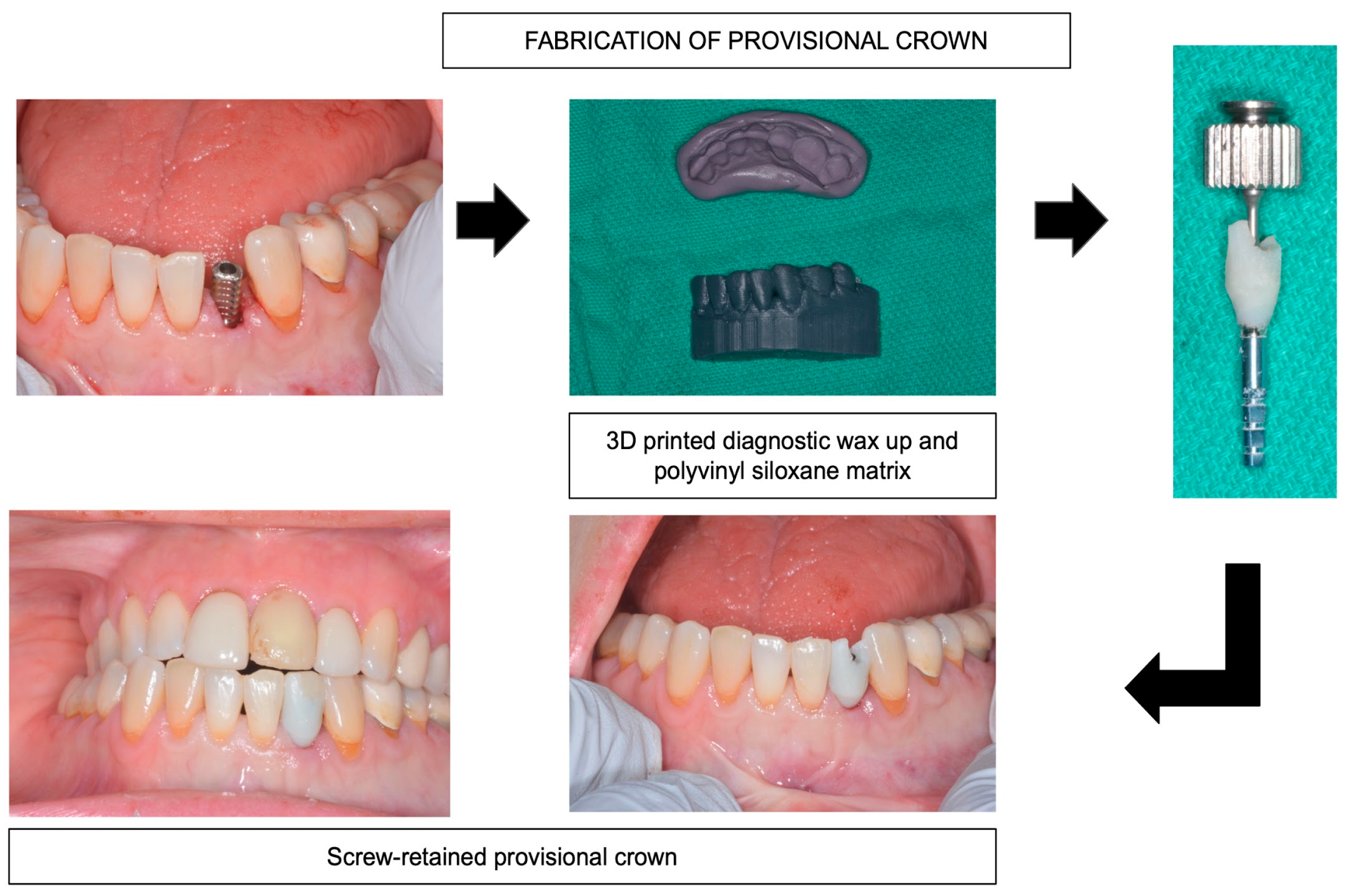 Prosthesis 05 00015 g003