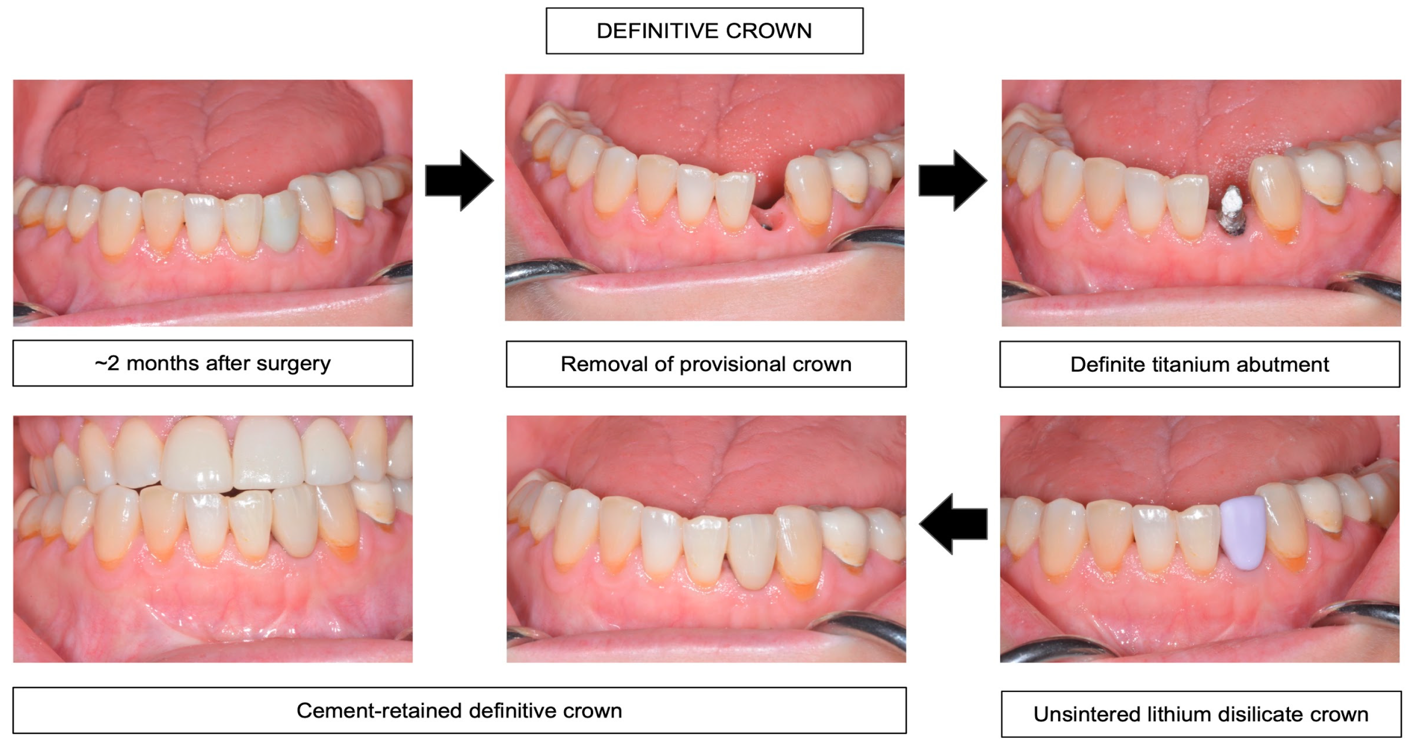 Prosthesis 05 00015 g004