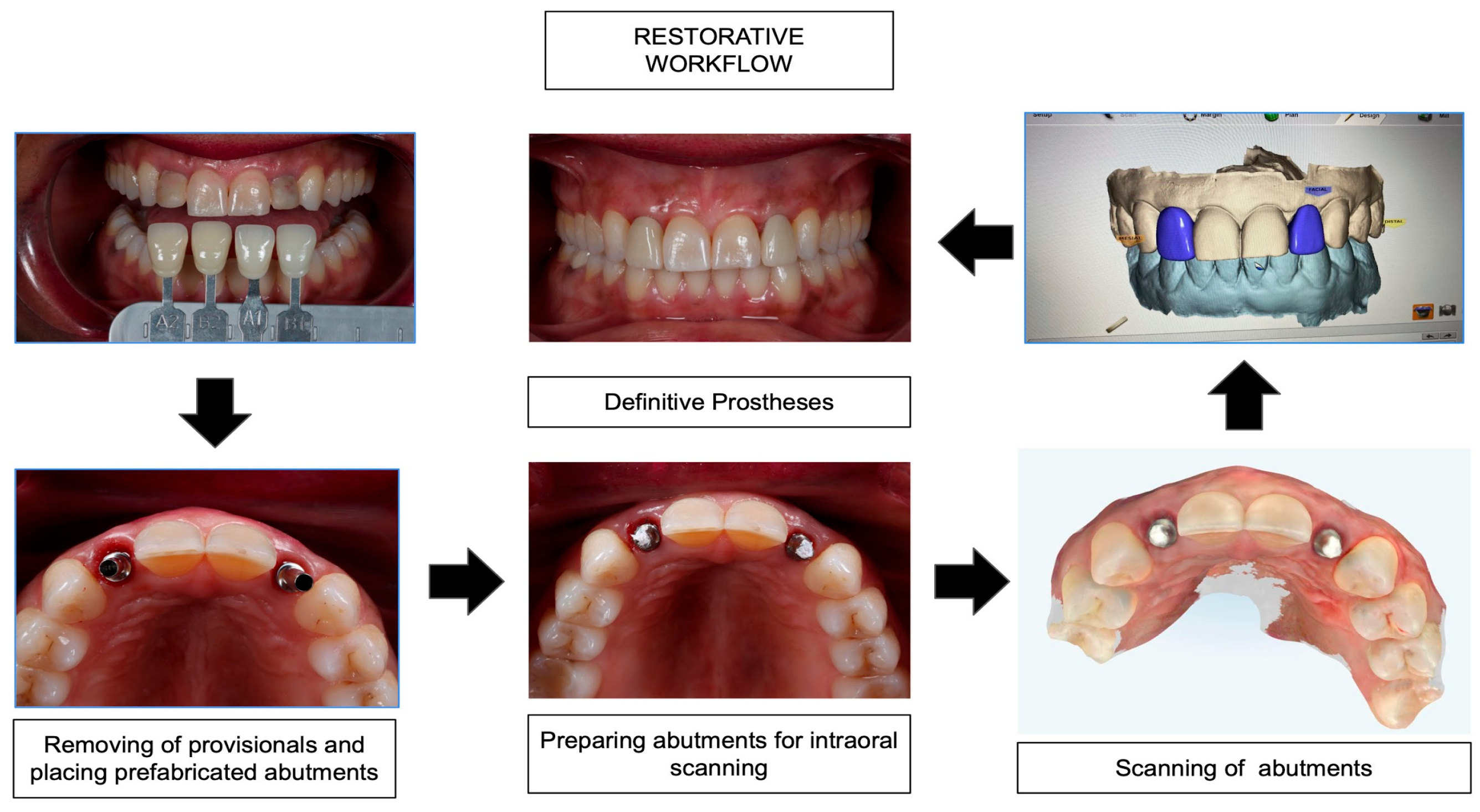 Prosthesis 05 00015 g005