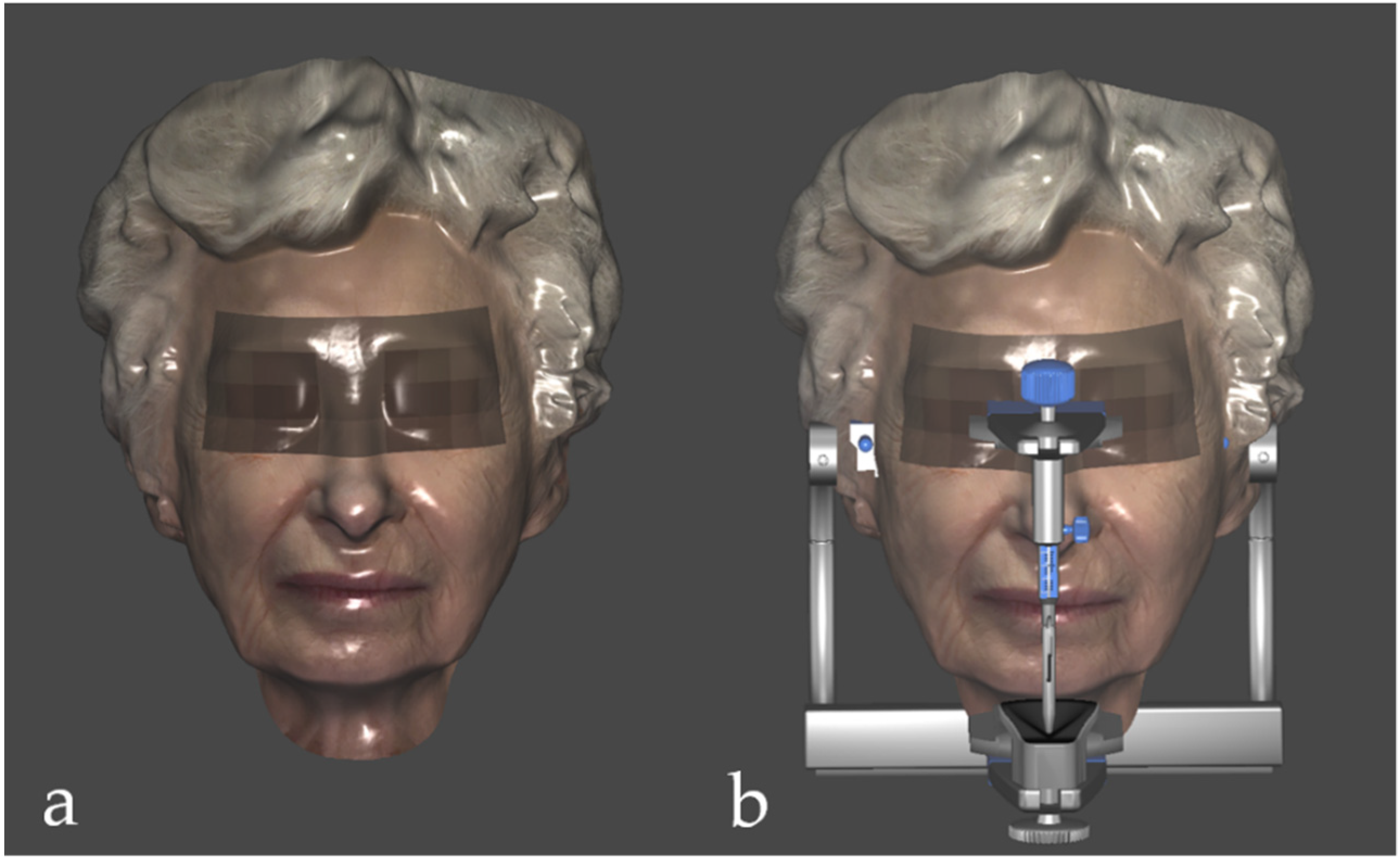 Prosthesis 05 00017 g002 Prosthesis 05 00017 g002