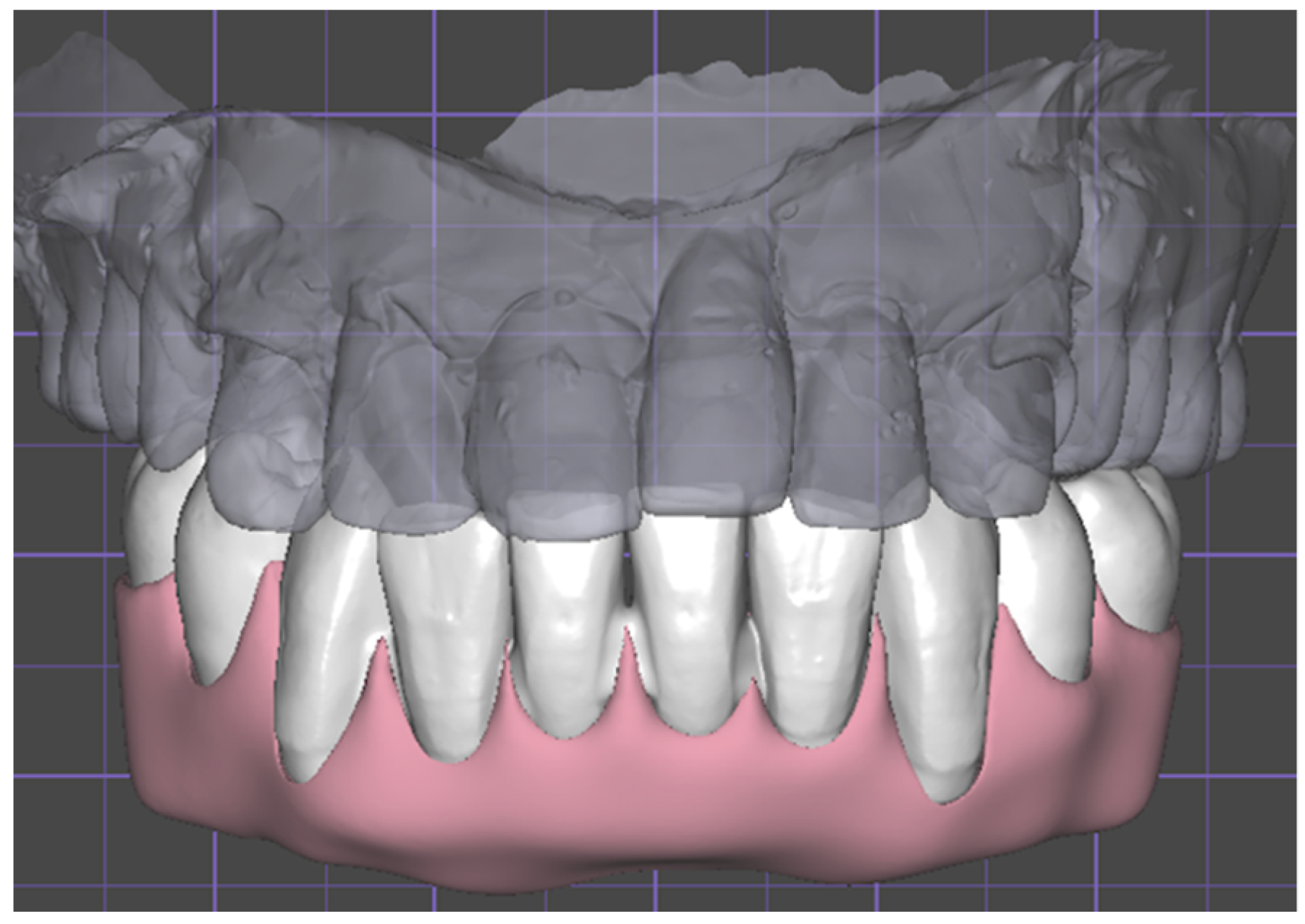 Prosthesis 05 00017 g003 Prosthesis 05 00017 g003