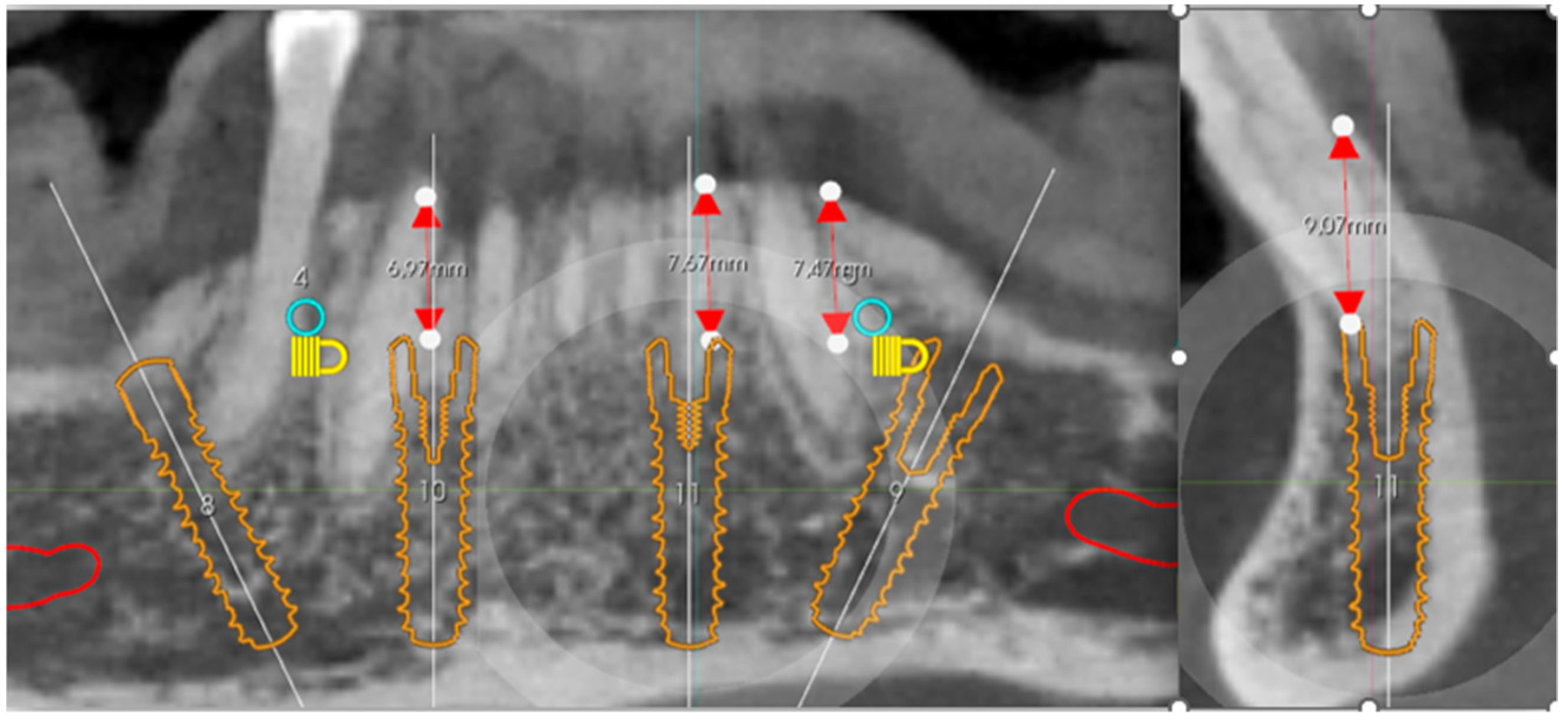Prosthesis 05 00017 g004 Prosthesis 05 00017 g004
