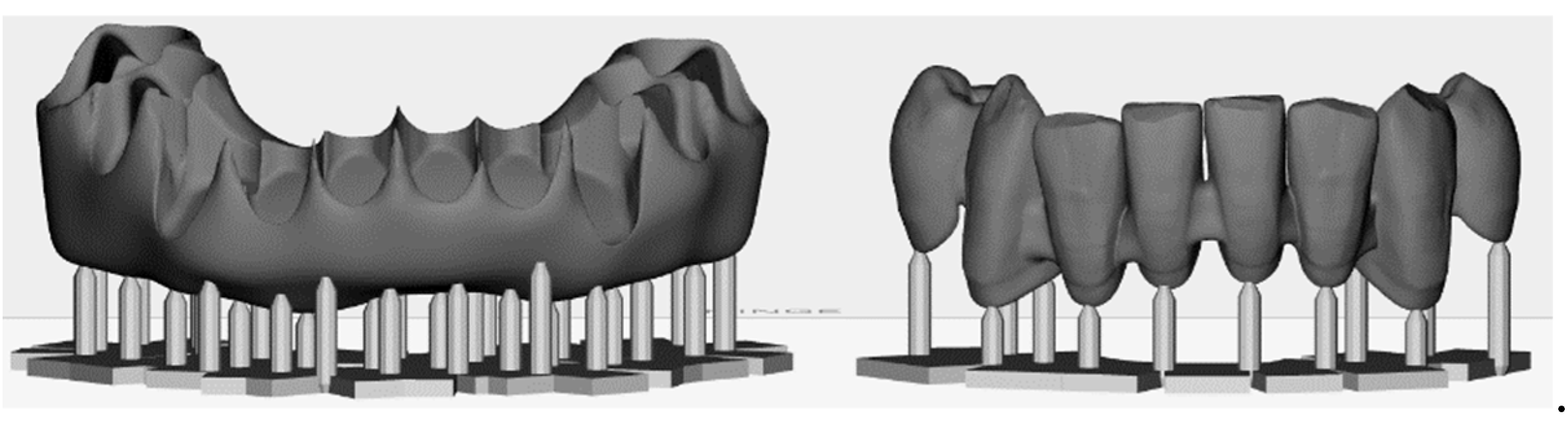 Prosthesis 05 00017 g007 Prosthesis 05 00017 g007