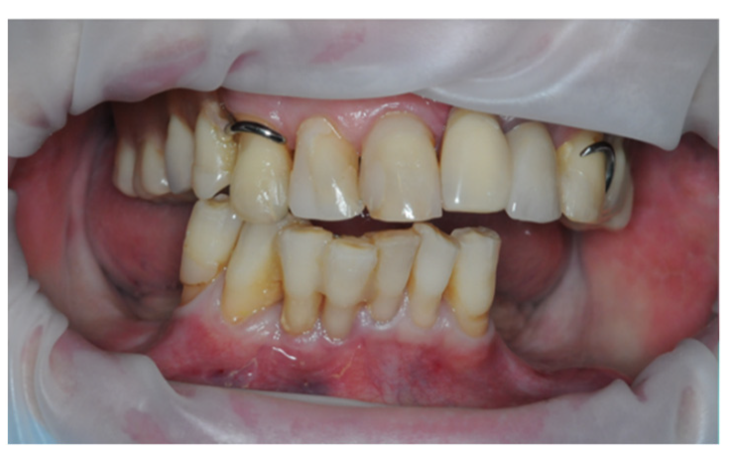 Prosthesis 05 00017 g008 Prosthesis 05 00017 g008