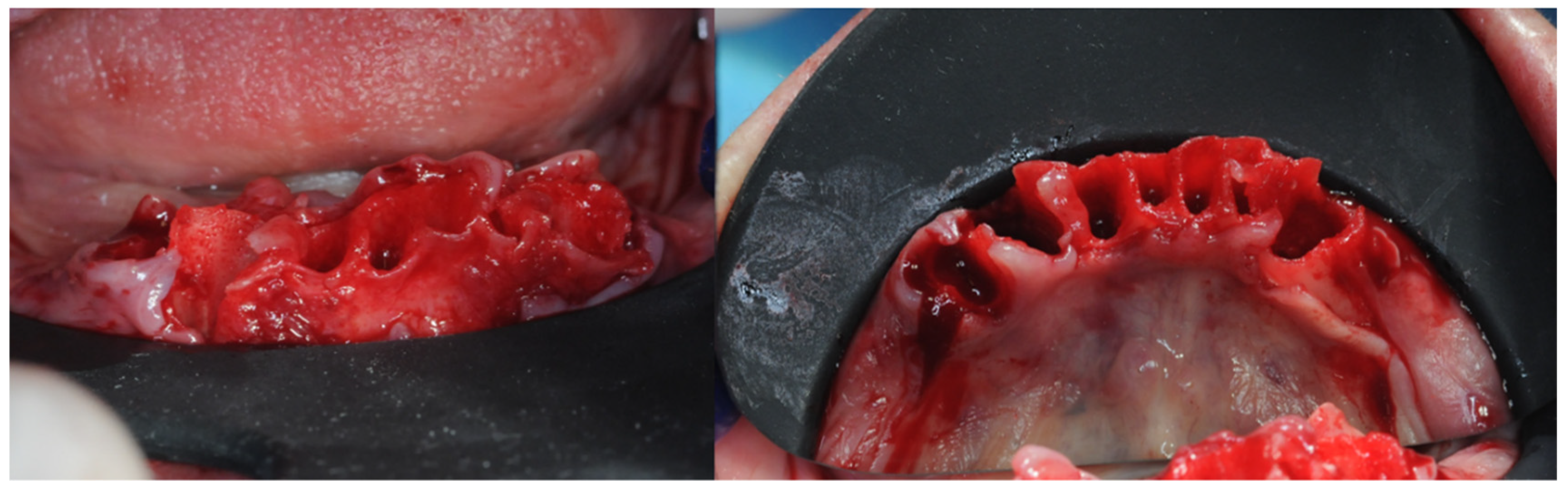 Prosthesis 05 00017 g010 Prosthesis 05 00017 g010